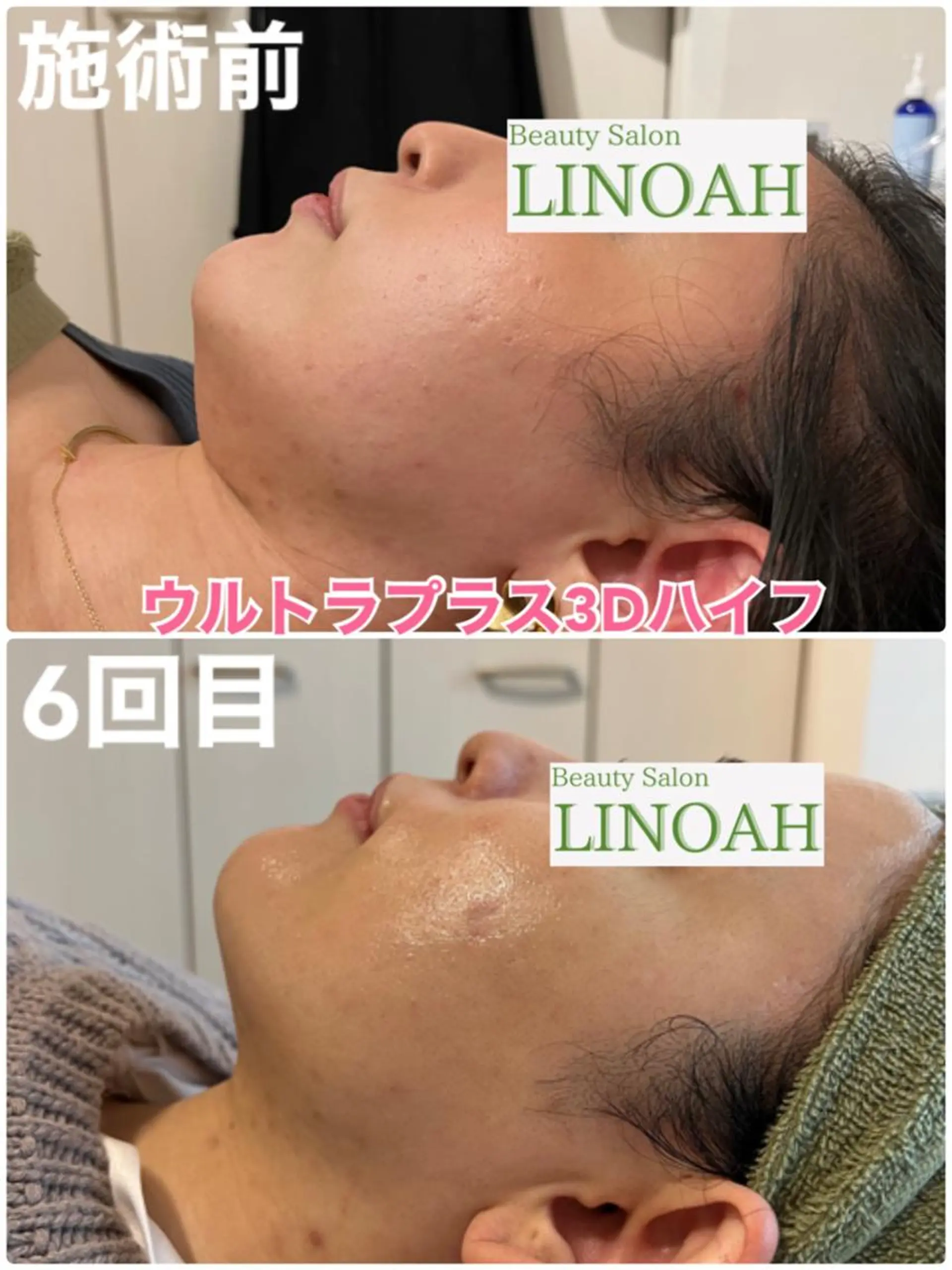 マツエク・マツパ アイブロウ メンズ エステ リラク ビューティーサロン リノアのエステ・リラクイメージ