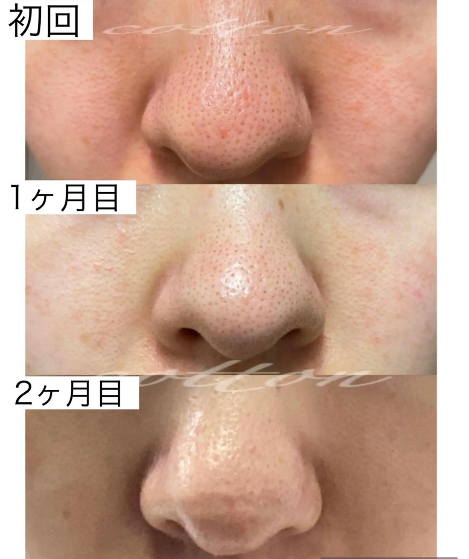 都度払い 肌質改善専門サロンのエステ・リラクイメージ