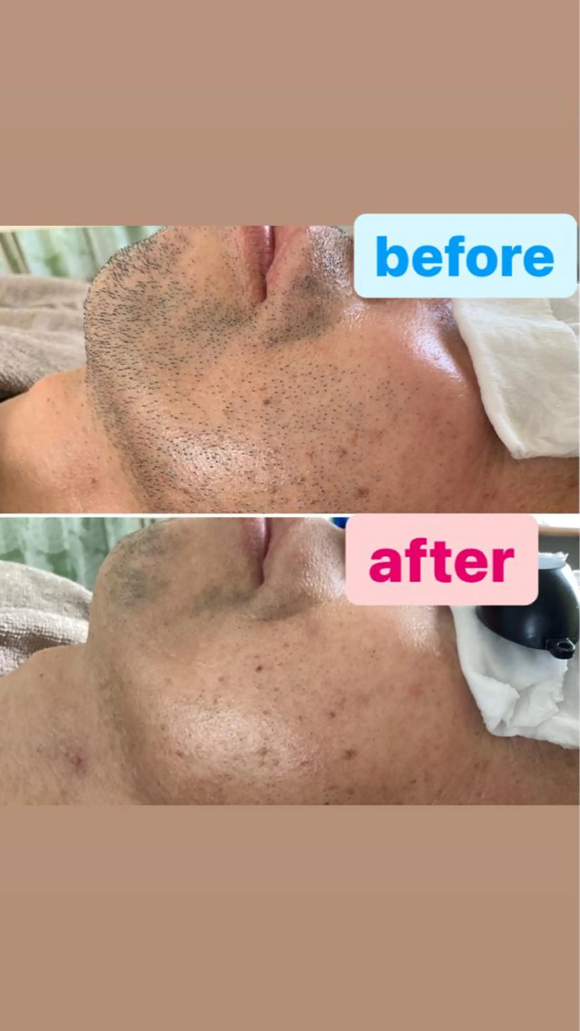 脱毛 美肌脱毛&光フェイシャルサロン　ギュネシ所属・脱毛&光フェイシャル サロン　ギュネシのエステ・リラクイメージ