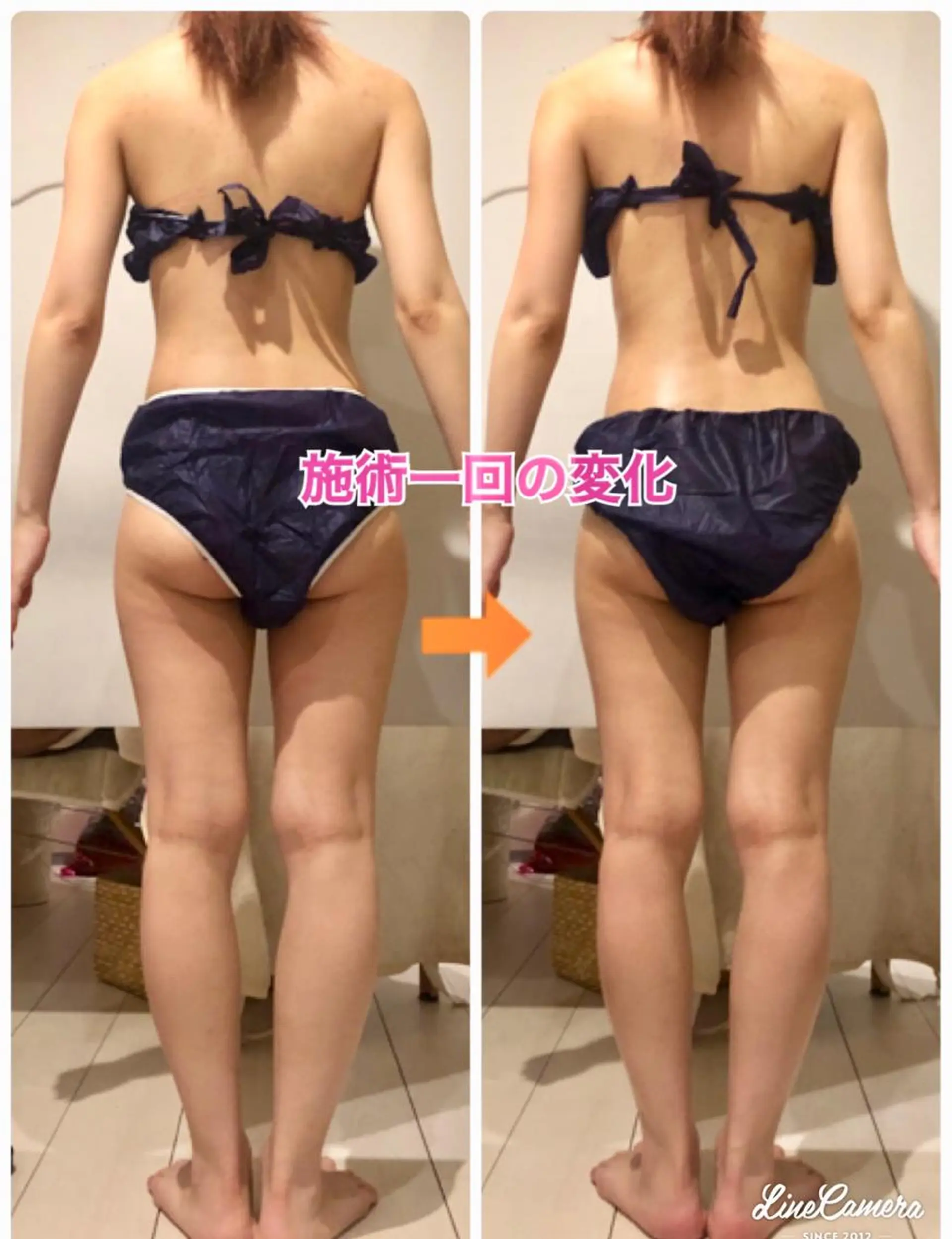 ショート カラー パーマ ヘアアレンジ メンズ キッズ ネイル マツエク・マツパ ‍痩身＆ボディ 結果出し🌟丹野のエステ・リラクイメージ