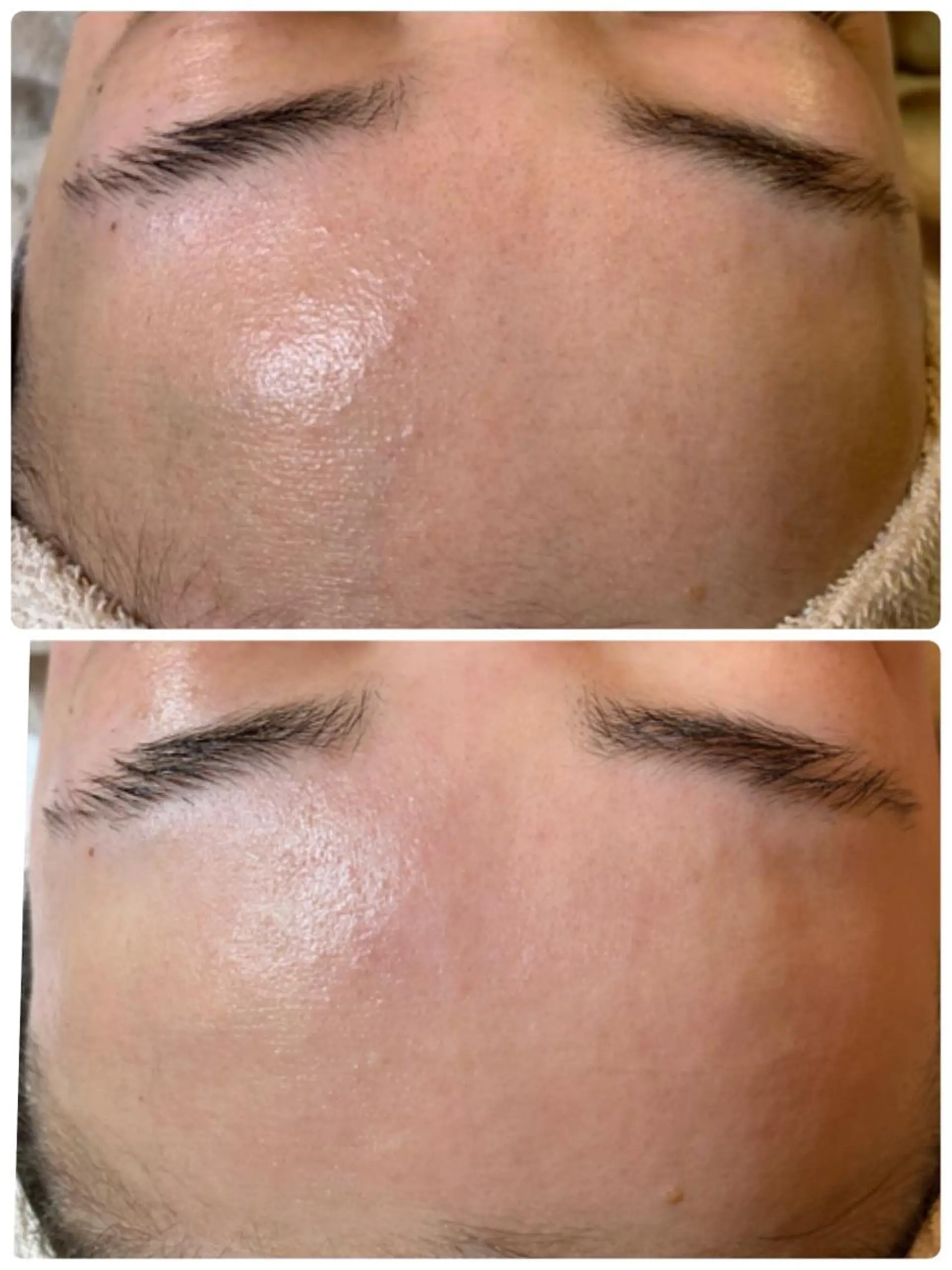 脱毛 Le cherien所属・Le cherien ルシェリアのエステ・リラクイメージ