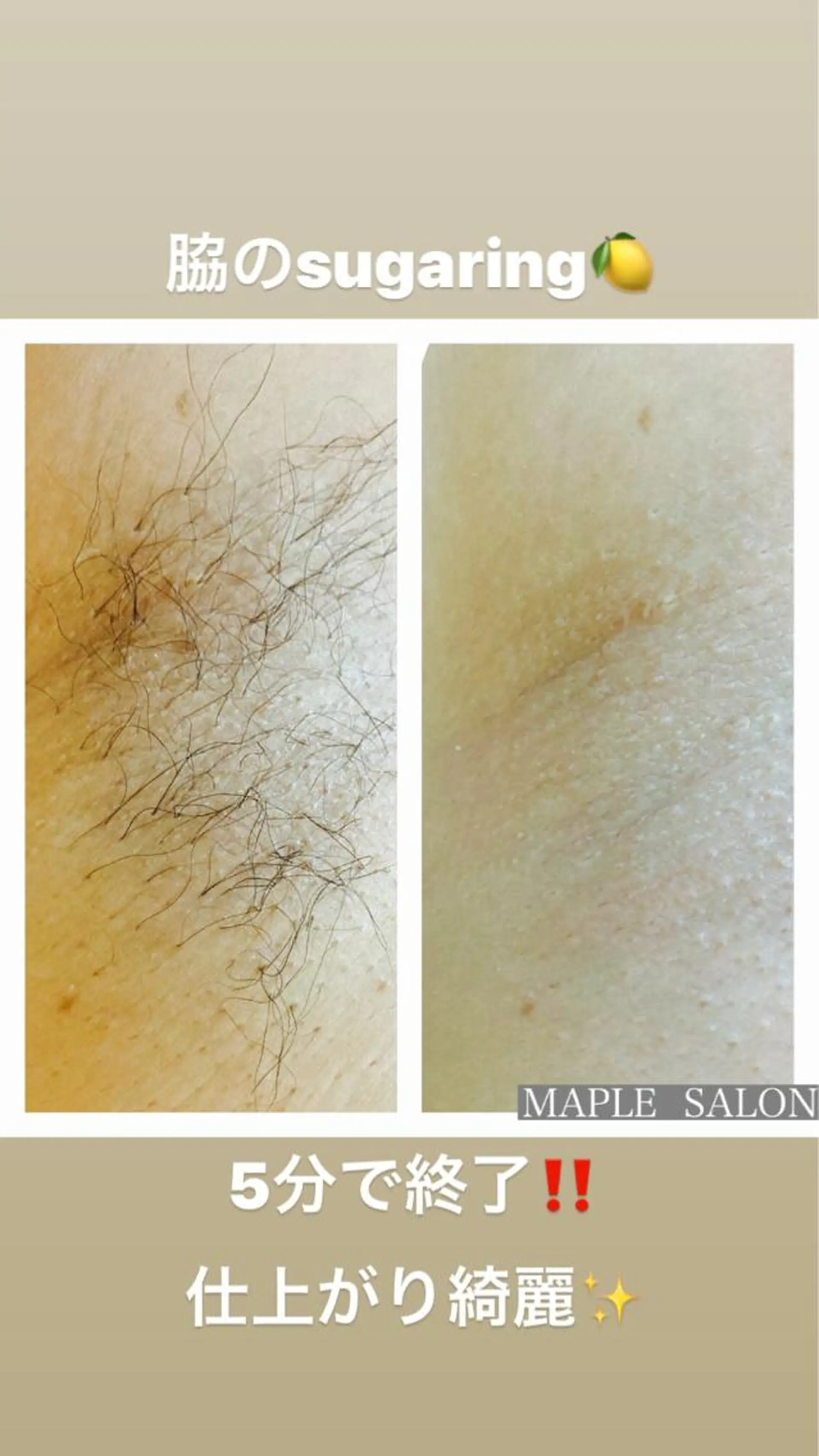 MARI シュガーリストのエステ・リラクイメージ