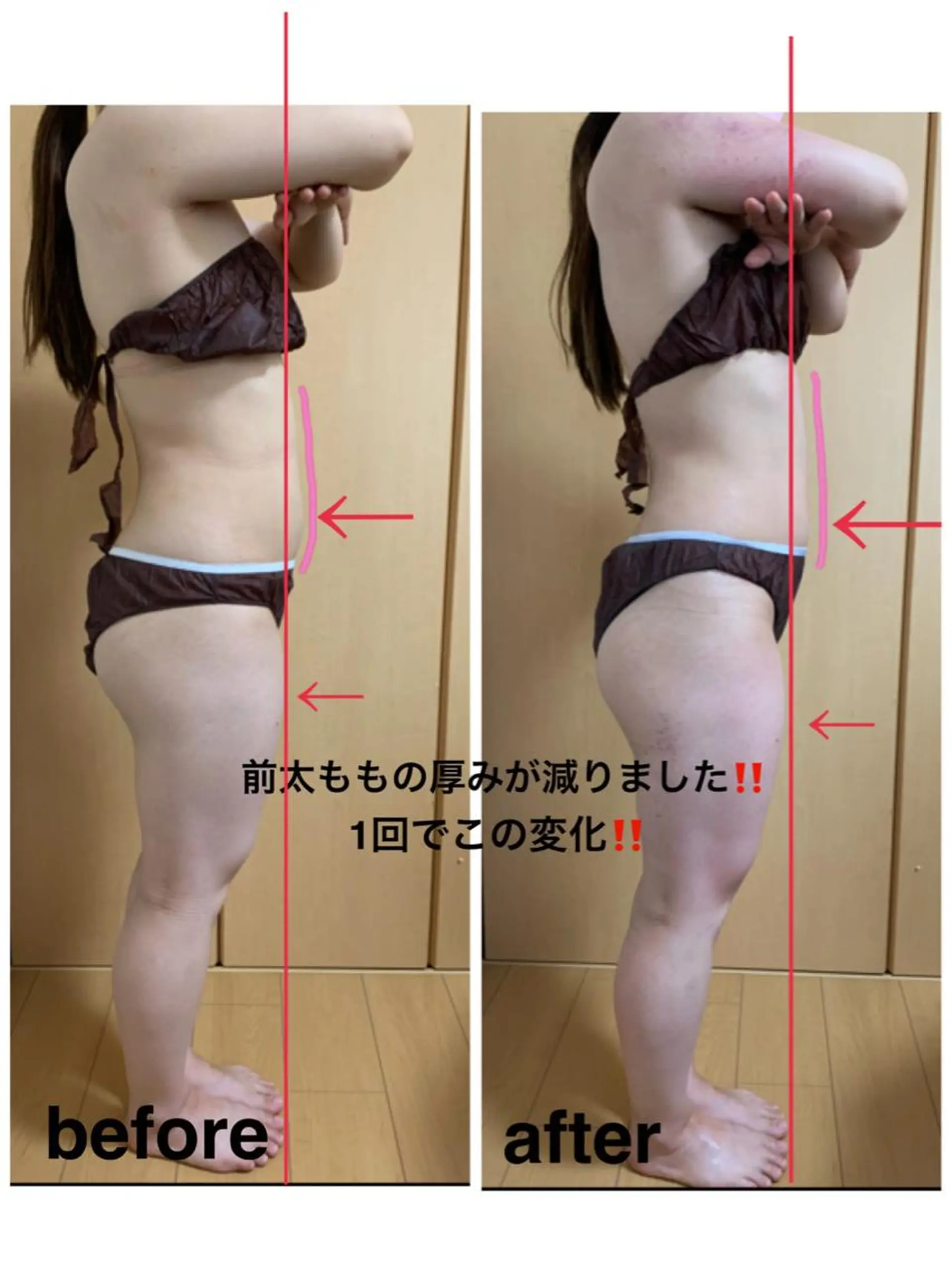 エステ リラク 痩身/脱毛/ネイル HARUKAのエステ・リラクイメージ