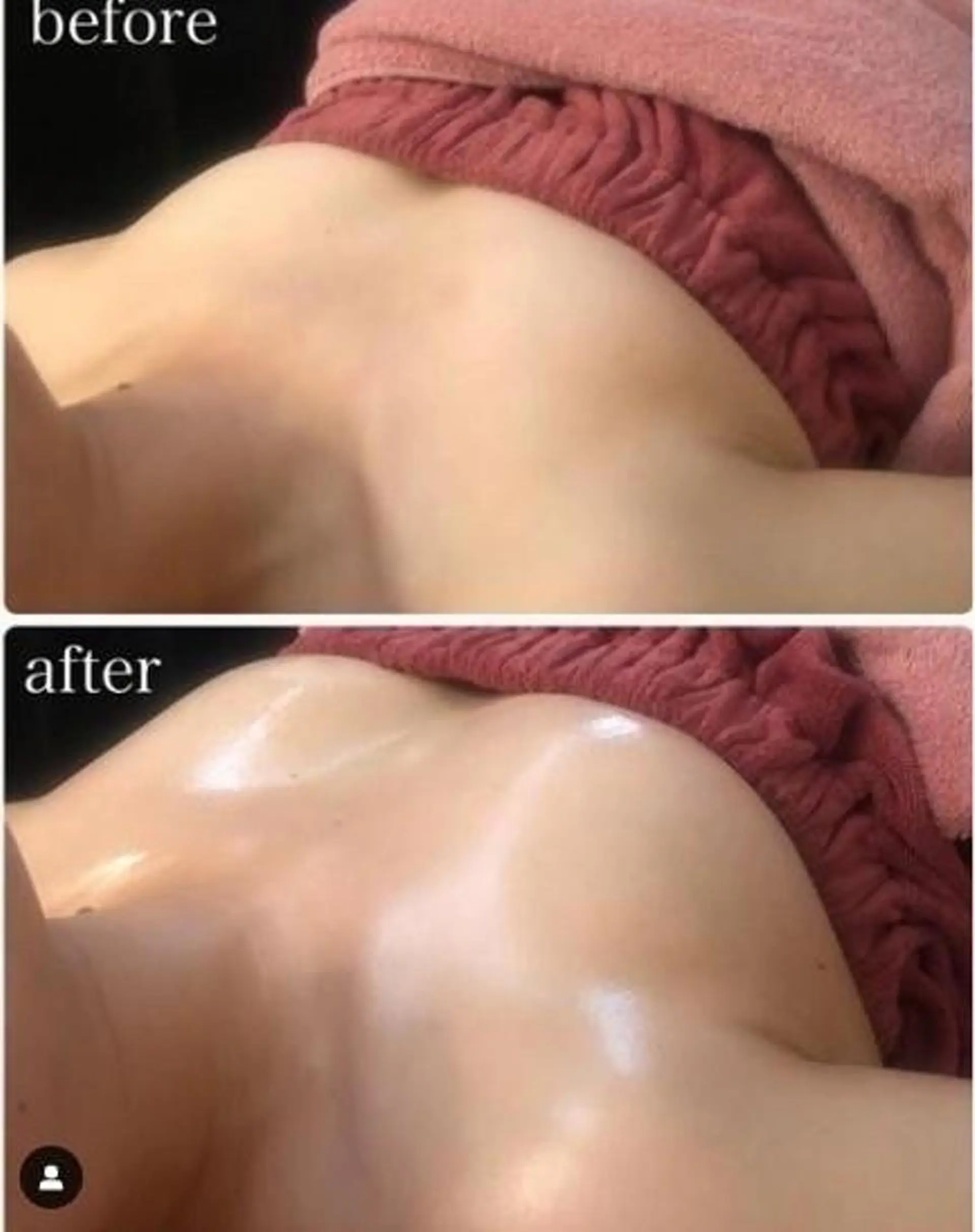 エステ 毛穴洗浄・痩身・脱毛 /アルカンジュのエステ・リラクイメージ