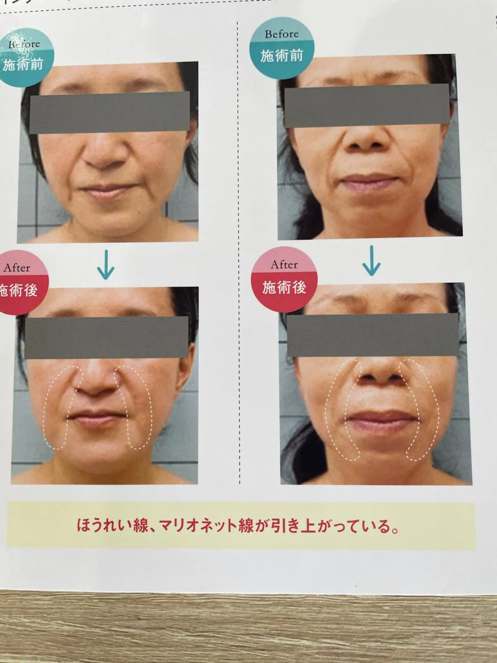 ビューティークリエイト所属・ビューティー クリエイトのエステ・リラクイメージ