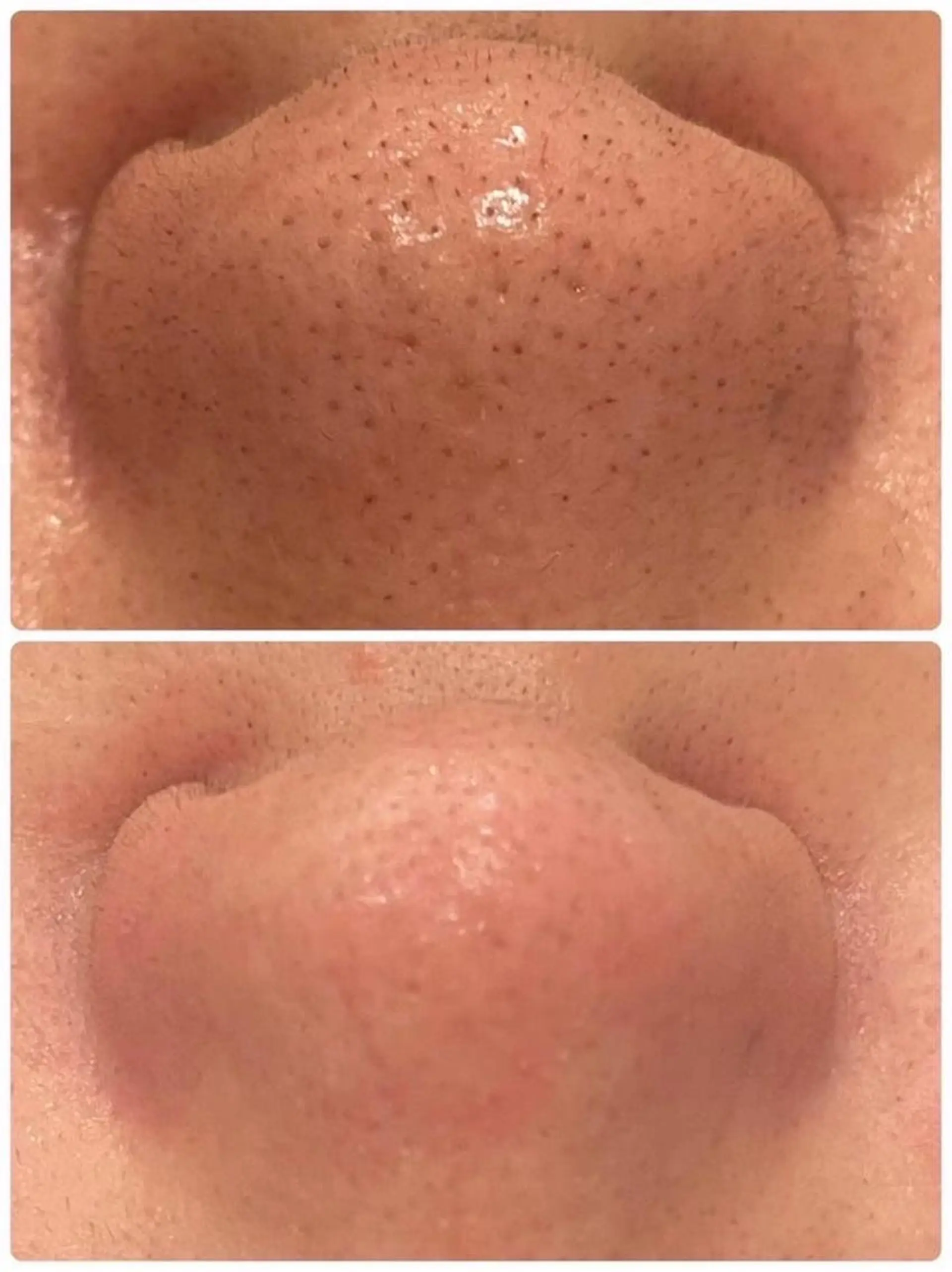 その他 脱毛×肌管理サロン ルネルのエステ・リラクイメージ