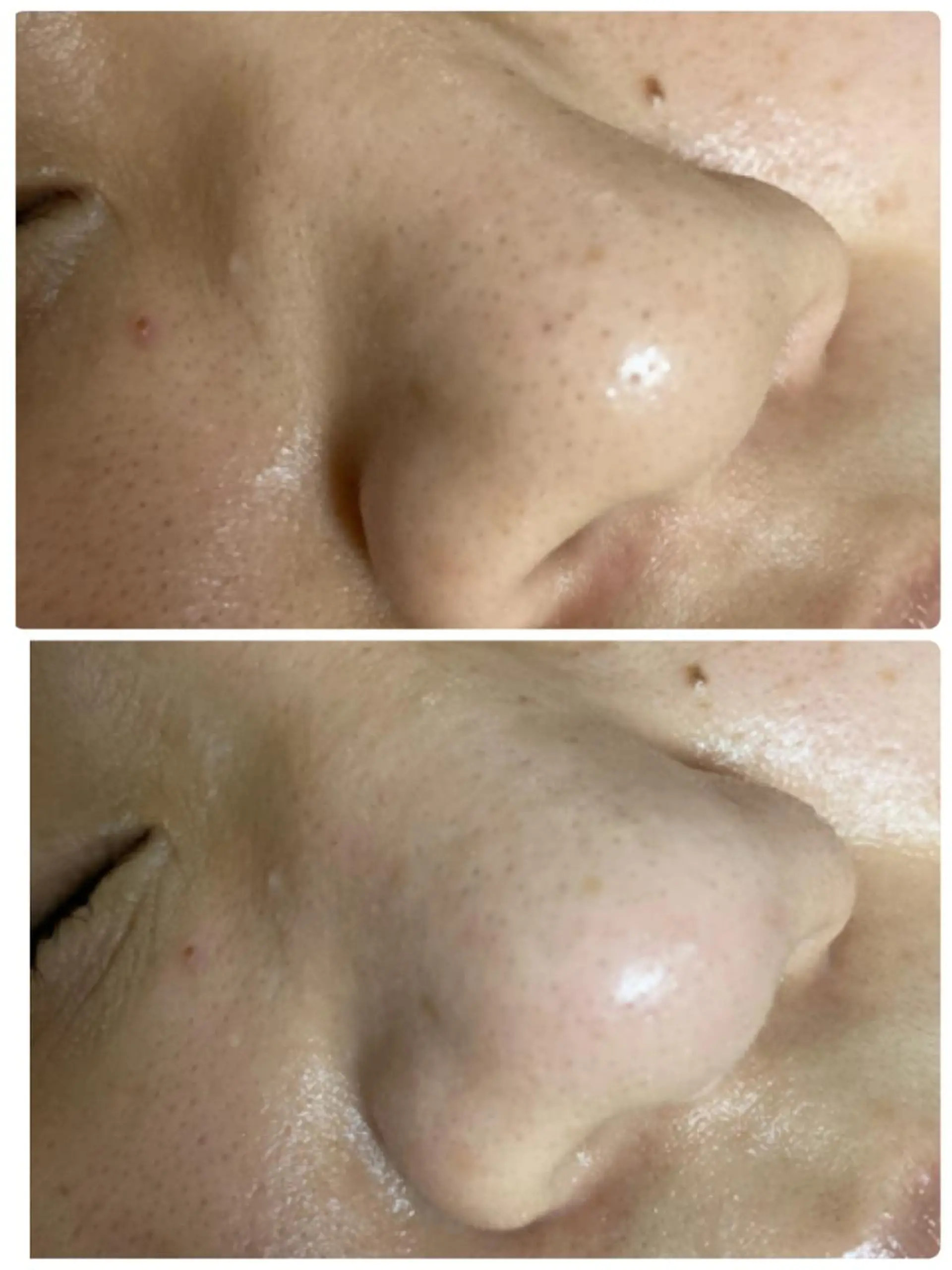 エステ emirai 🌙AYANOのエステ・リラクイメージ