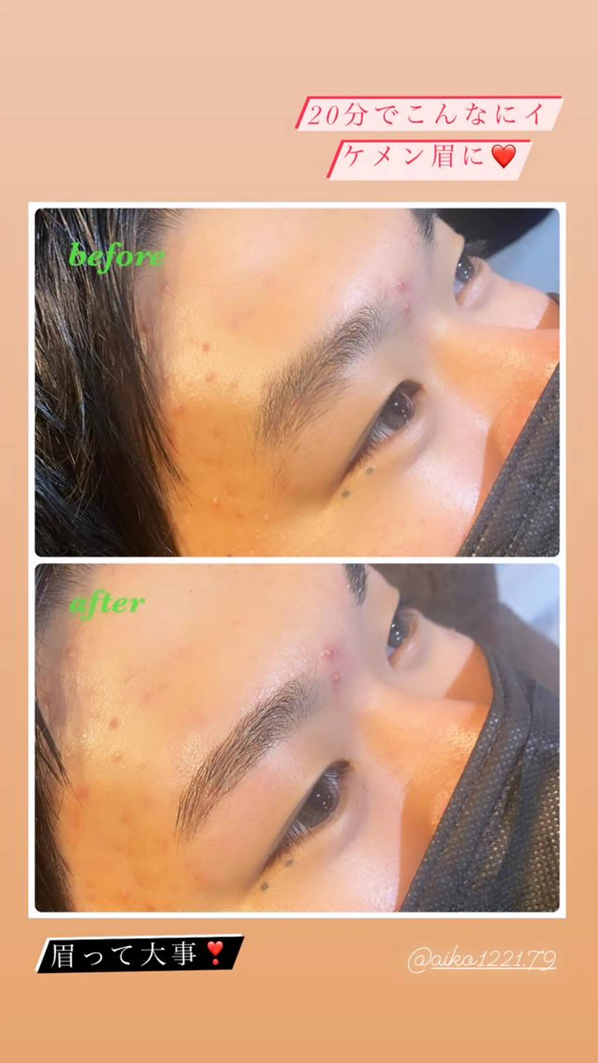 アイブロウ ハーブピーリング/韓国肌管理/フェイシャル/毛穴洗浄/眉毛/顔脱毛【糸脱毛専門】rev所属・ハーブピーリング🌹 毛穴洗浄❤️眉waxのエステ・リラクイメージ