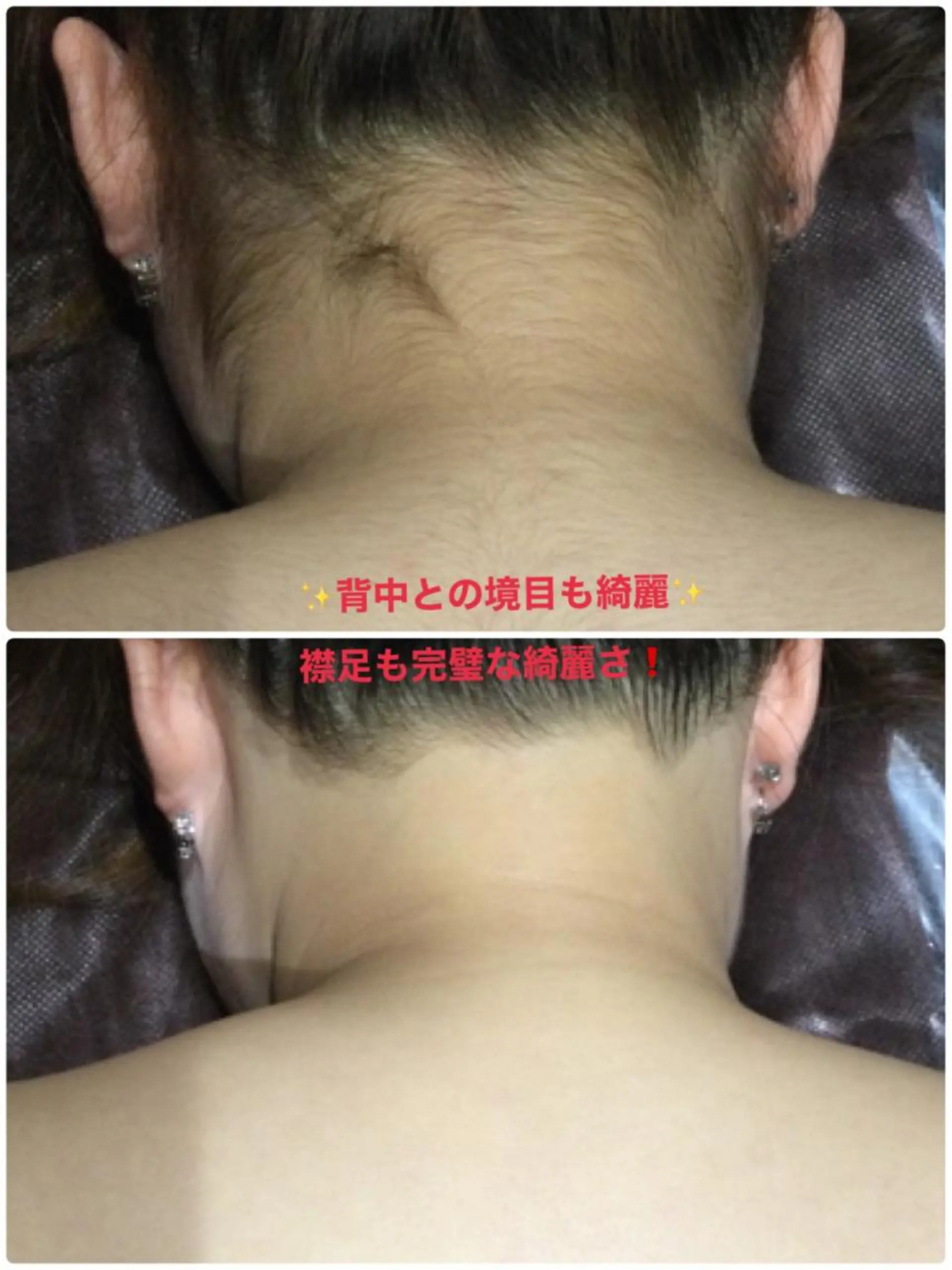 脱毛 Ange -viva la vida-所属・Esthesalon -Ange-のエステ・リラクイメージ