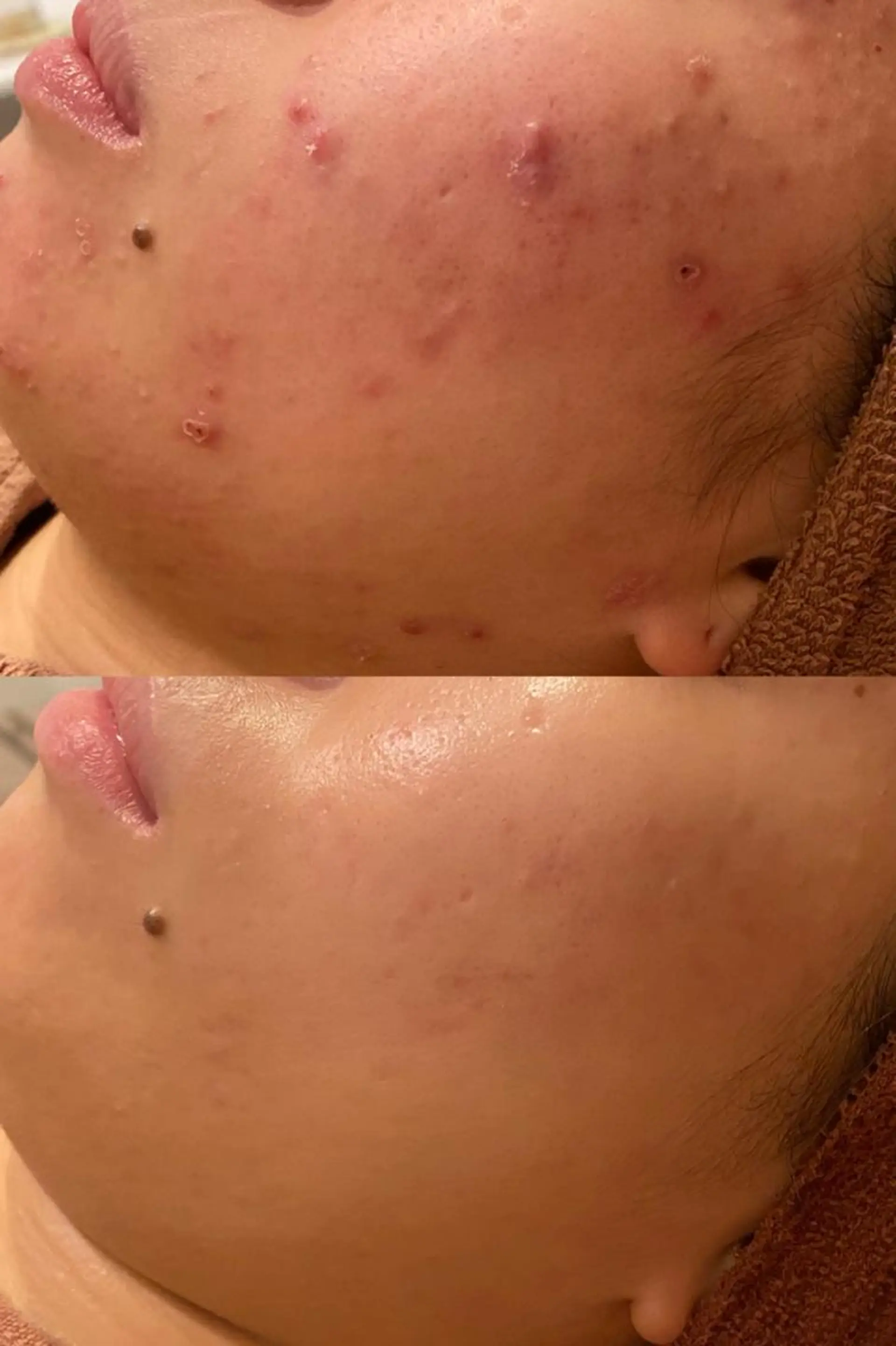 エステ リラク ニキビ・肌質改善専門 ♡人生が変わるサロンのエステ・リラクイメージ