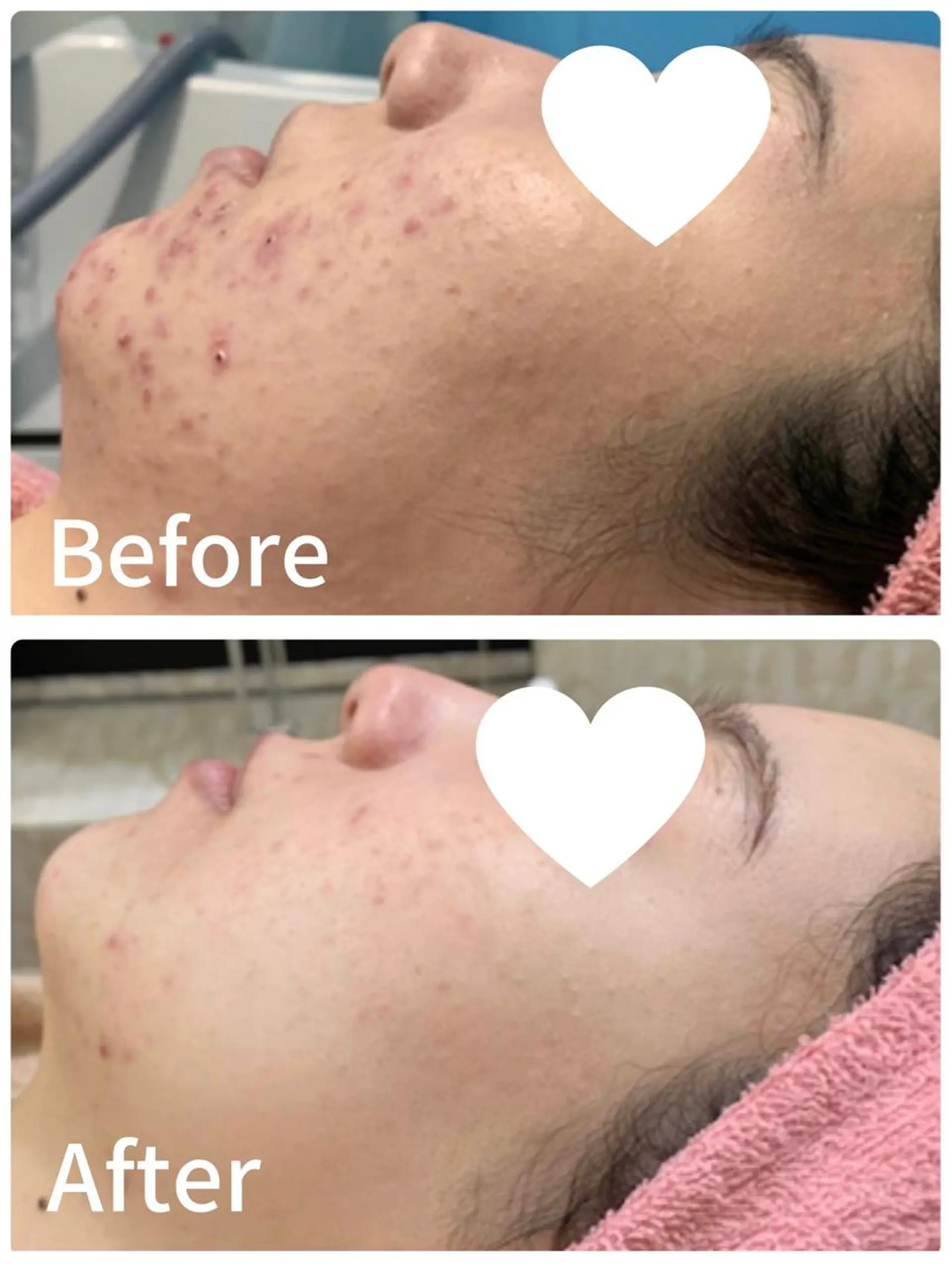 エステ 垣田 ジョアアンジェ京橋のエステ・リラクイメージ