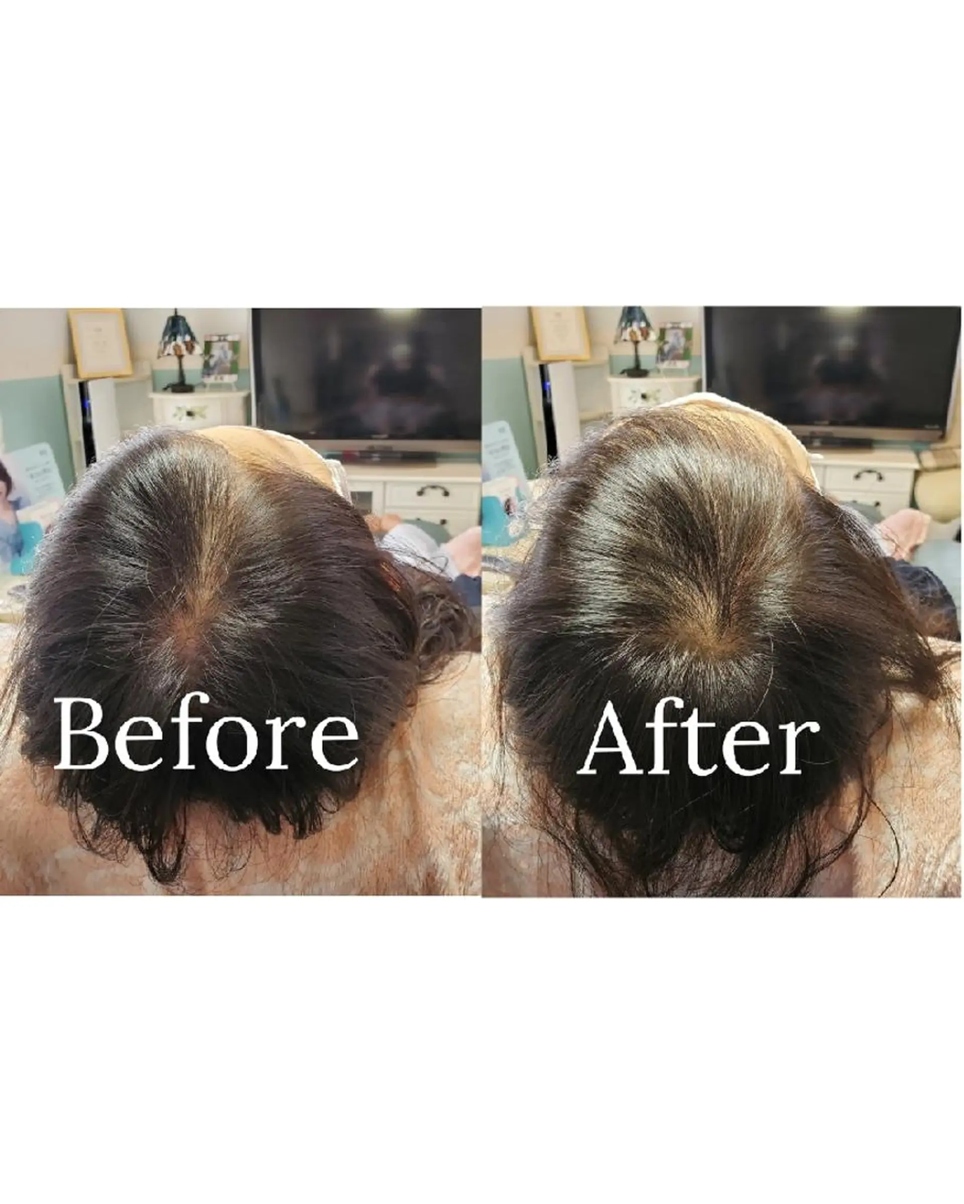 歯科提携セルフダック 宇都宮駒生店のエステ・リラクイメージ