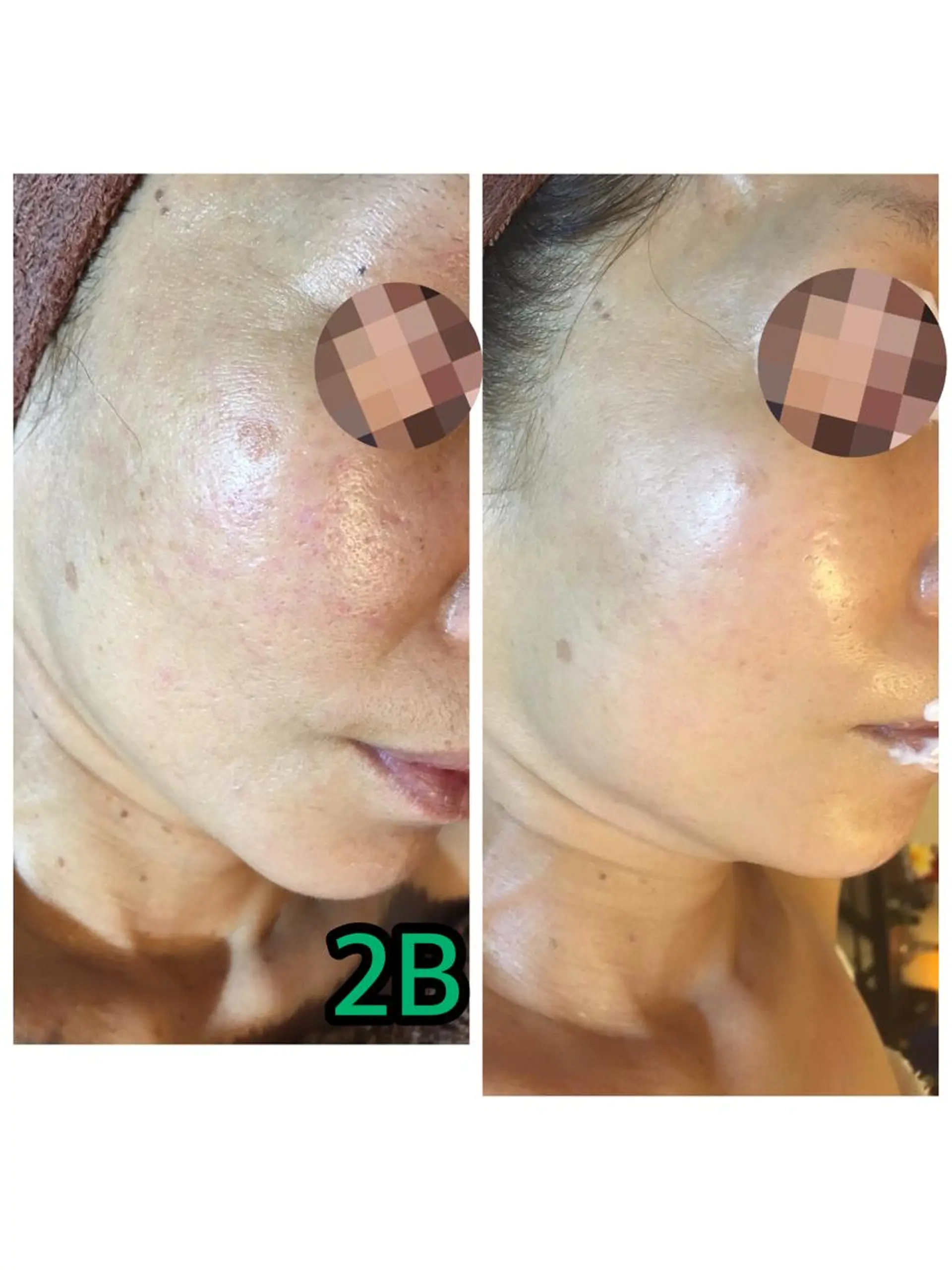 Totalbeautysalon Coco所属・Coco caoriのマツエク・マツパデザイン