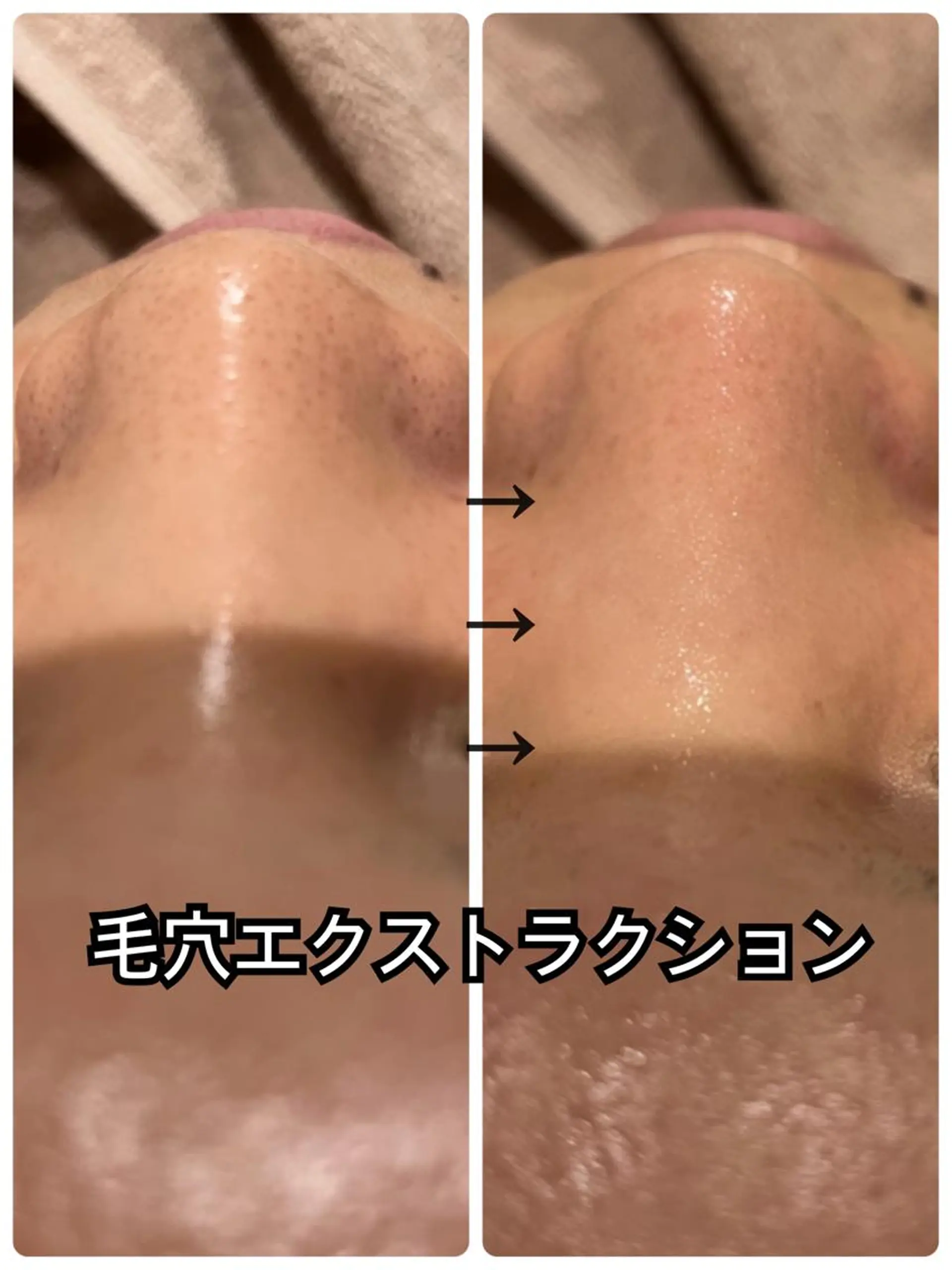 エステ Dione八王子店所属・LUKE （ルーク）のエステ・リラクイメージ