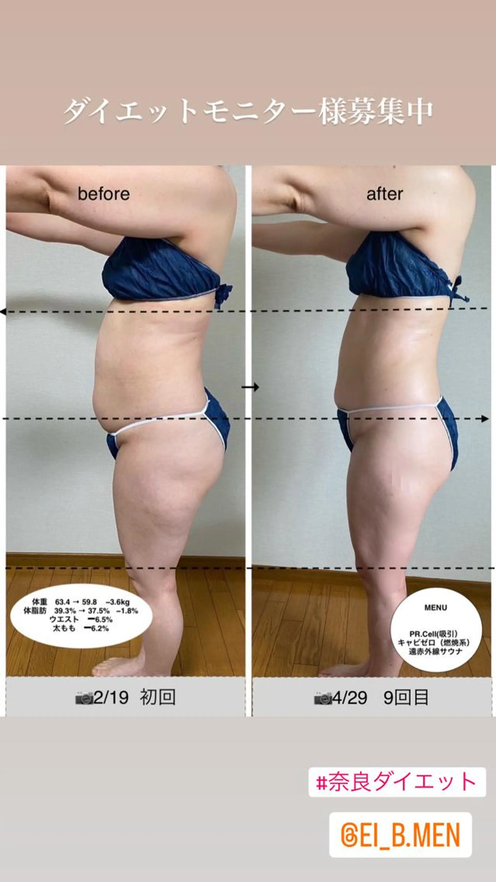 その他 ダイエット／脱毛 美顔／フォト／ハーブのその他イメージ