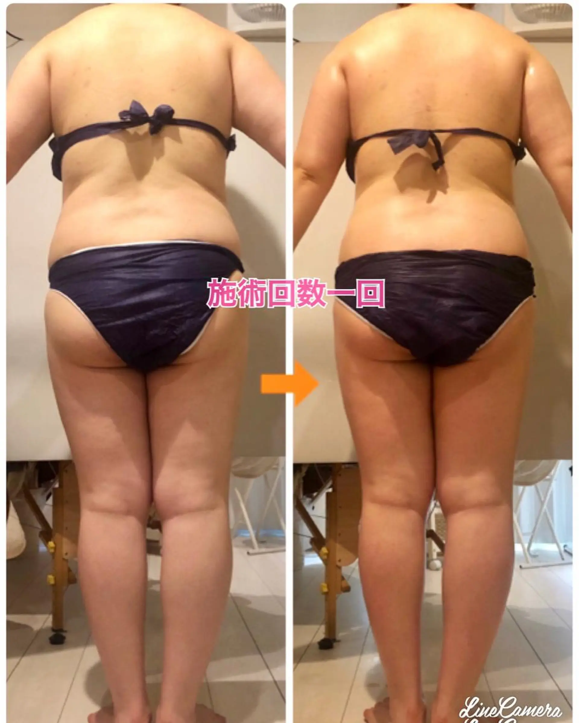 ショート カラー パーマ ヘアアレンジ メンズ キッズ ネイル マツエク・マツパ ‍痩身＆ボディ 結果出し🌟丹野のエステ・リラクイメージ