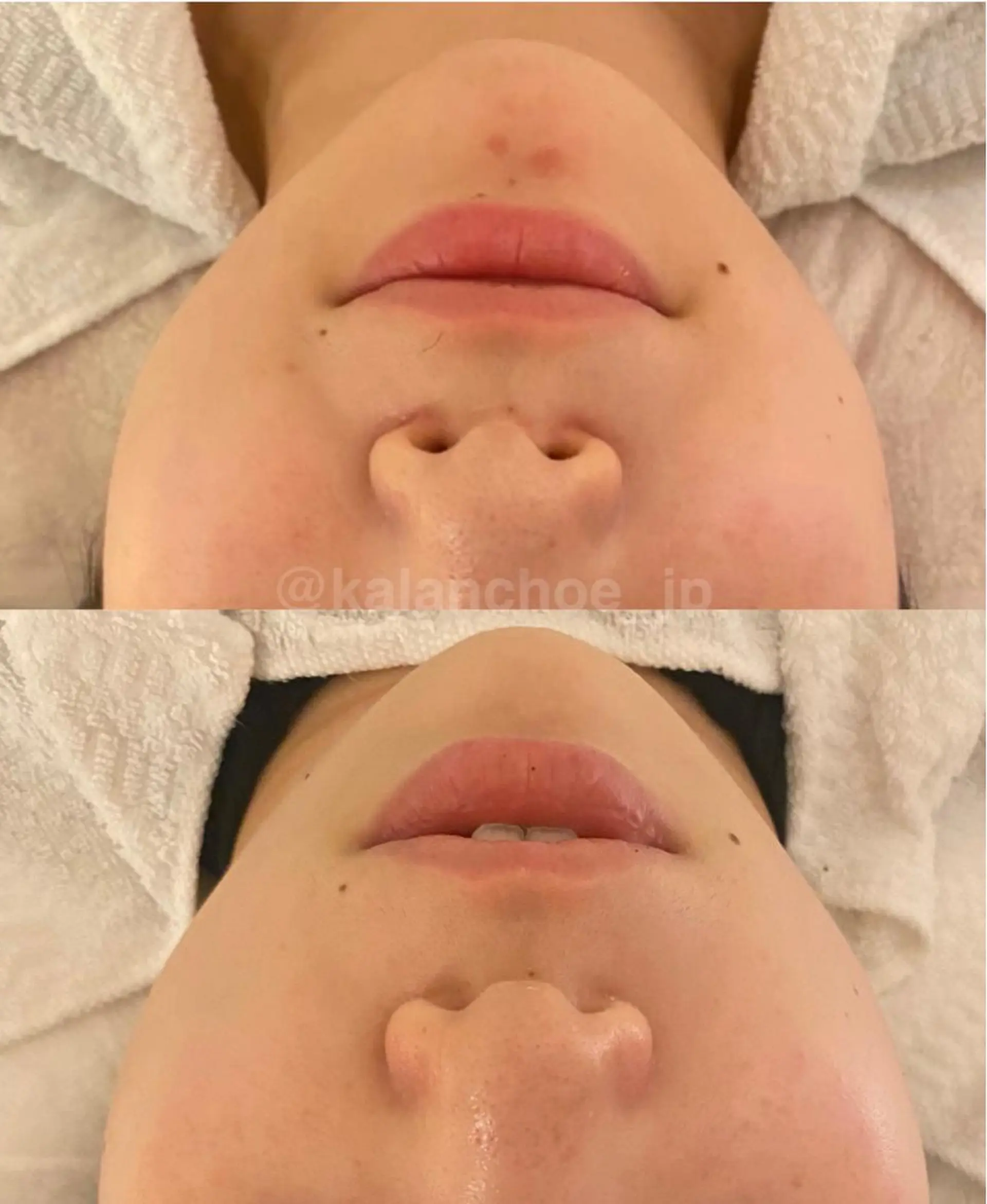 エステ 肌質改善 KALANCHOEのエステ・リラクイメージ