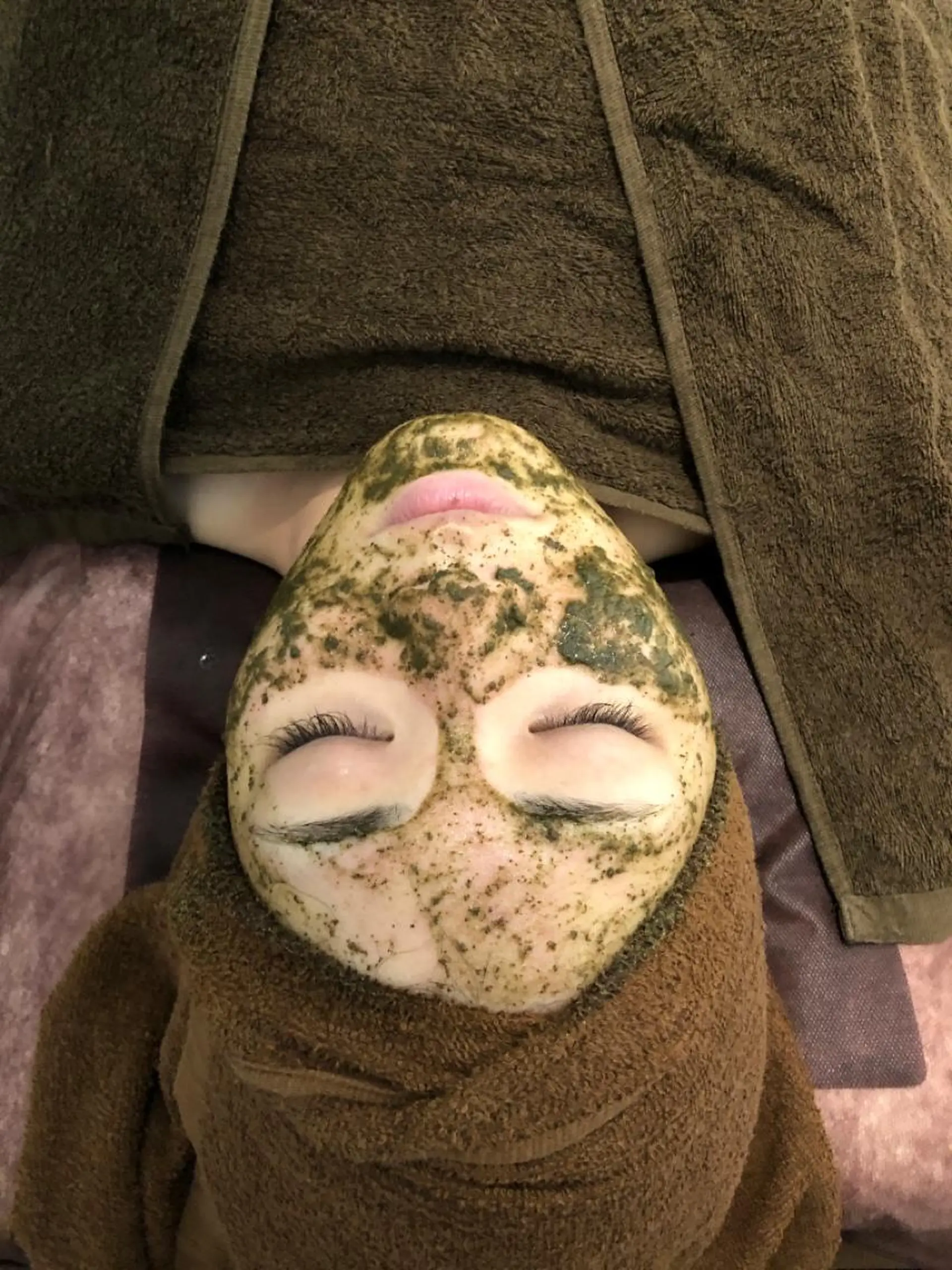 エステ 美容鍼灸整体サロンBeauJu所属・小顔矯/美容鍼/鍼灸 BeauJuのその他イメージ