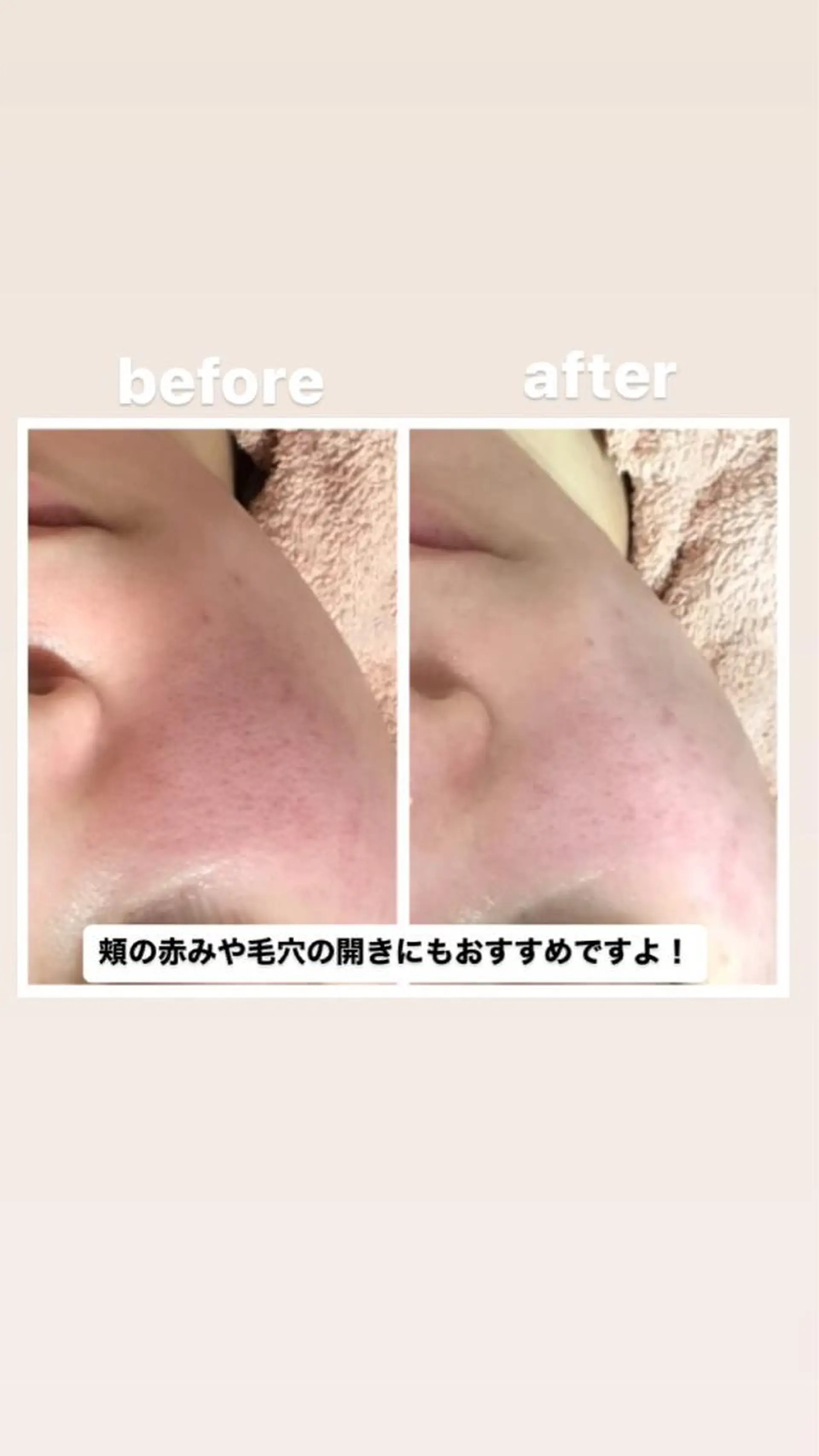 エステ リラク Anya Beautyのエステ・リラクイメージ