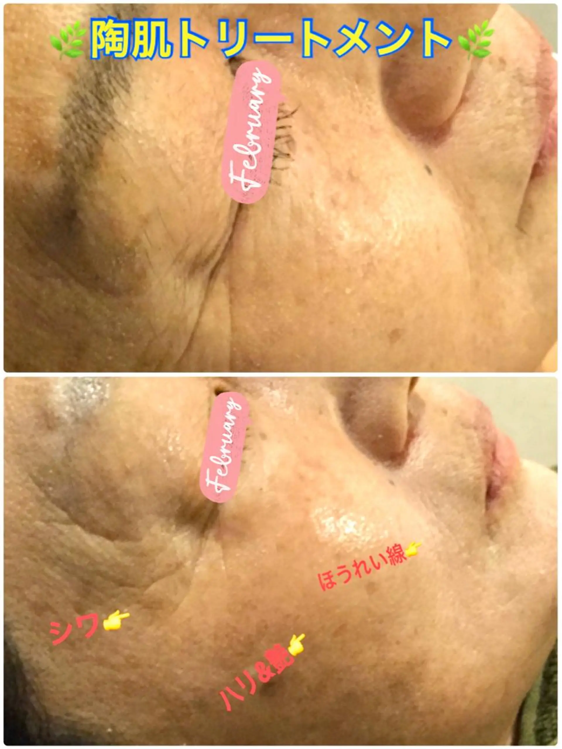 エステ 【リベルハーブピーリング認定店】敏感肌・美白脱毛専門店Dione立川店所属・Dione 立川店のエステ・リラクイメージ