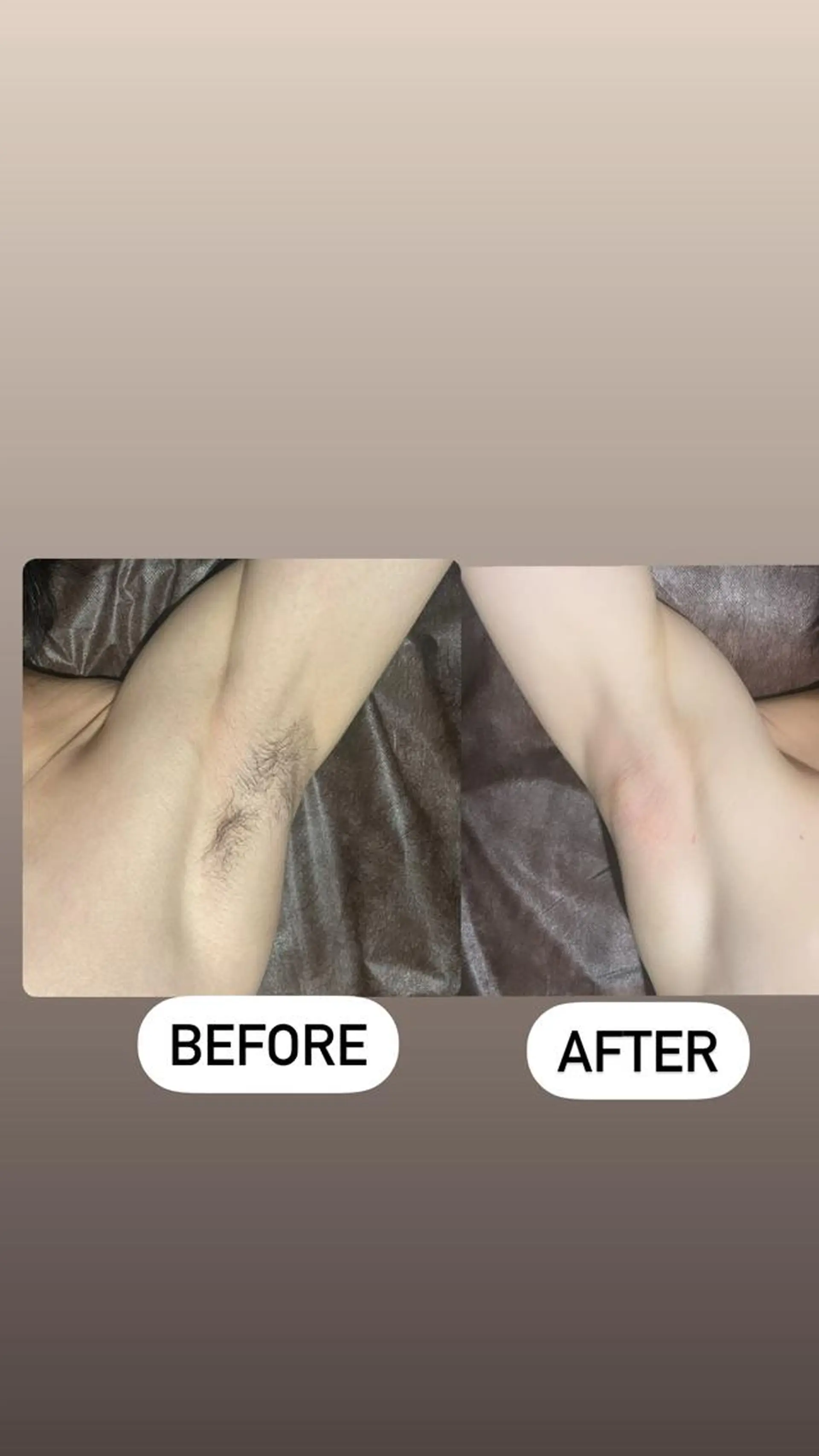 メンズ 脱毛 メンズ眉毛ITSUK Iメンズ専門　新宿の眉毛・アイブロウイメージ