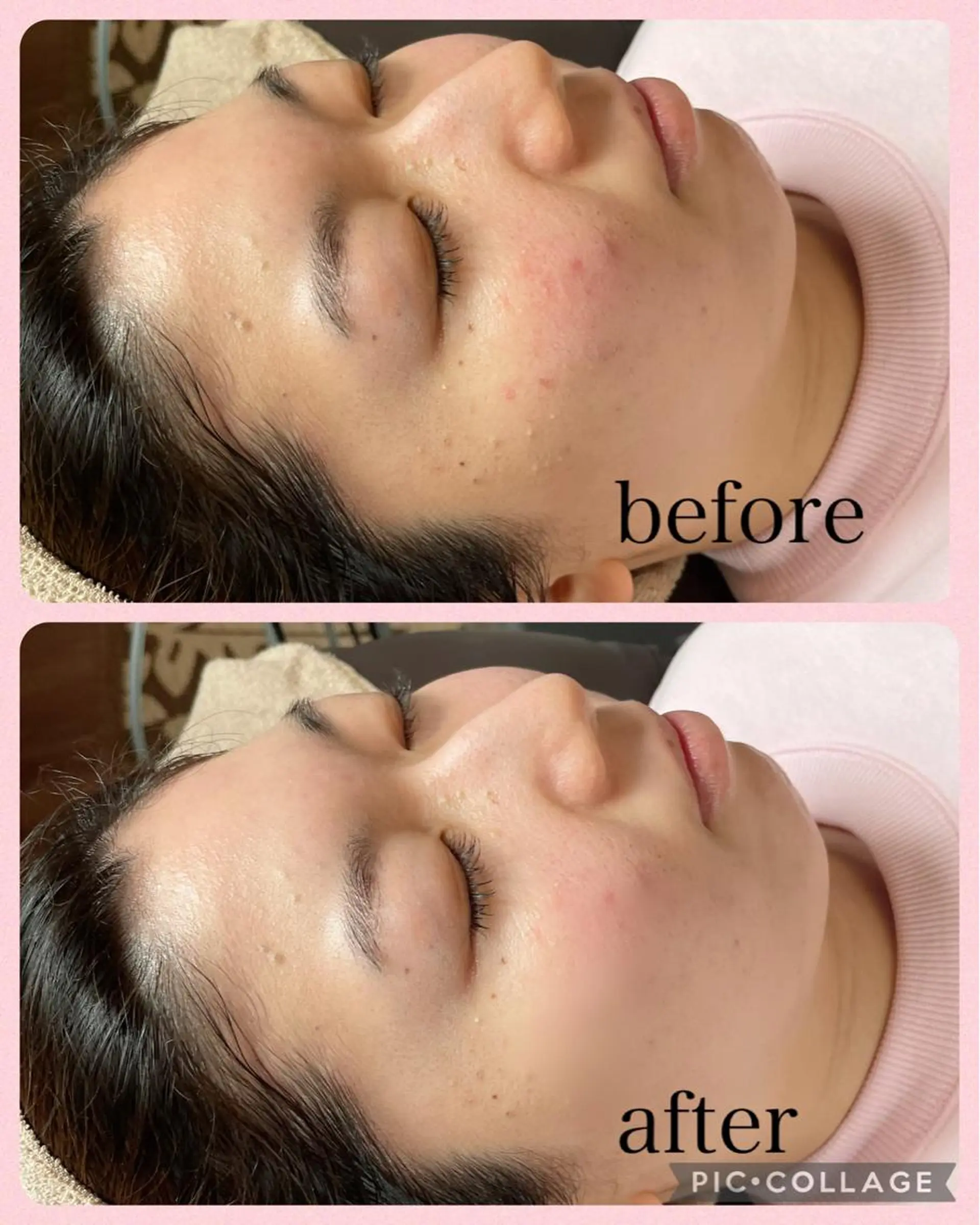 NATURA所属・シェービングサロン NATURAのエステ・リラクイメージ