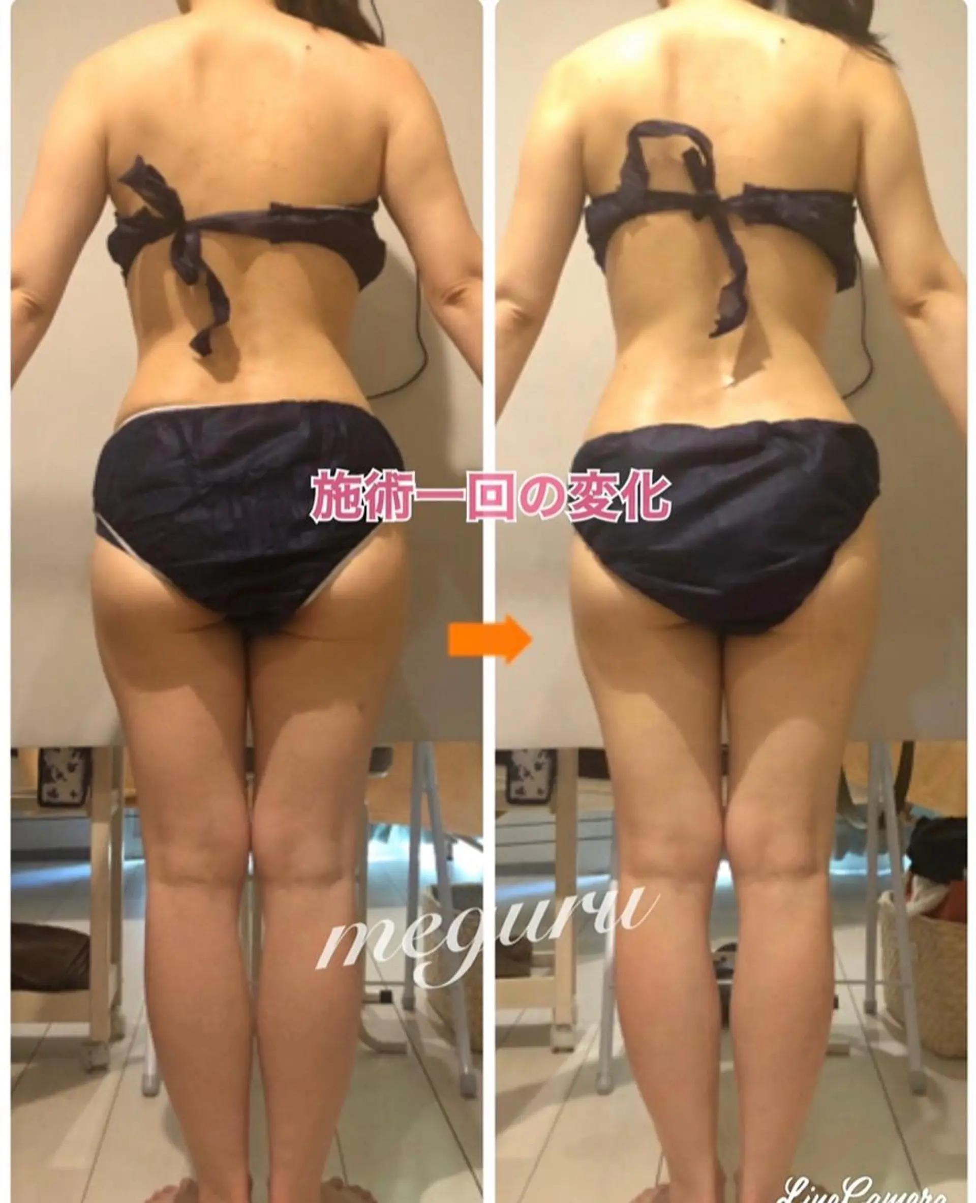 ショート カラー パーマ ヘアアレンジ メンズ キッズ ネイル マツエク・マツパ エステ リラク 痩身&ボディ 結果出し🌟丹野のエステ・リラクイメージ