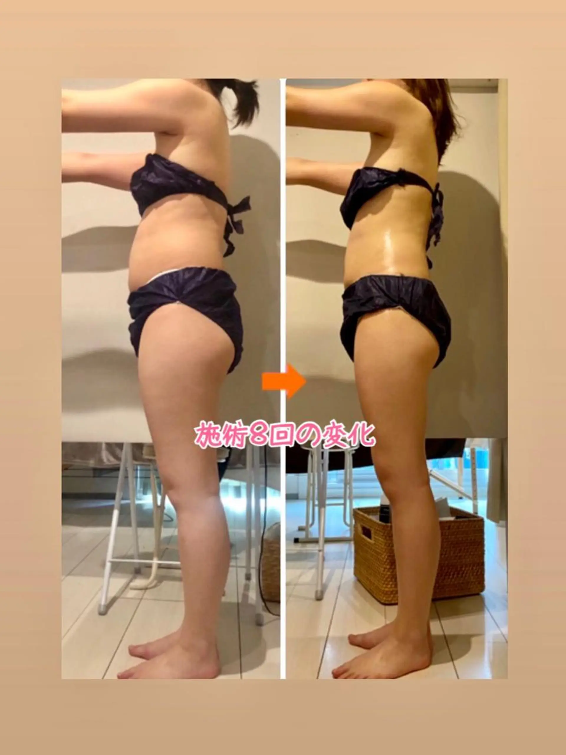 ショート カラー パーマ ヘアアレンジ メンズ キッズ ネイル マツエク・マツパ ‍痩身＆ボディ 結果出し🌟丹野のエステ・リラクイメージ