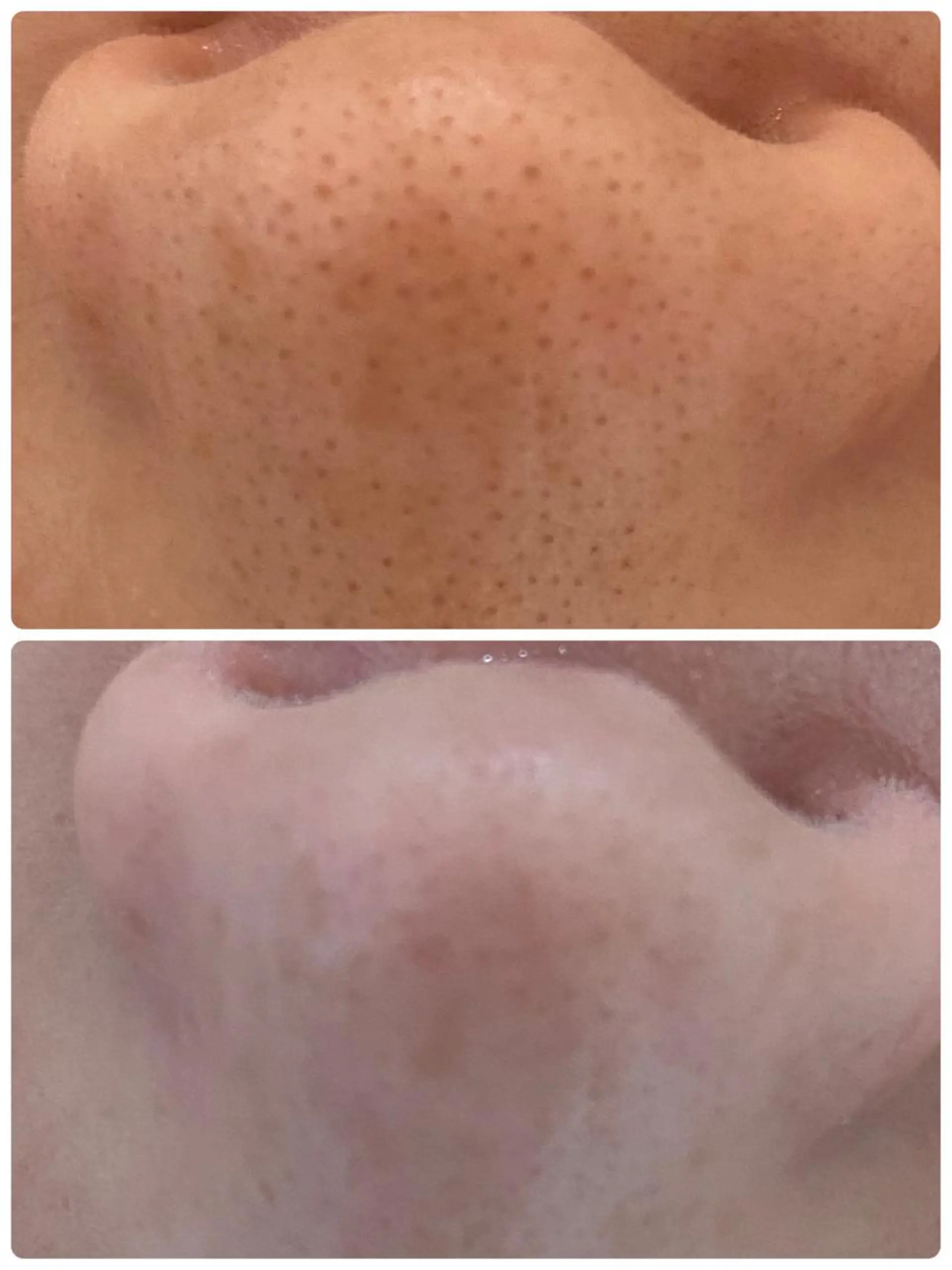 小顔・毛穴/ニキビ/ ハーブピーリング専門のエステ・リラクイメージ