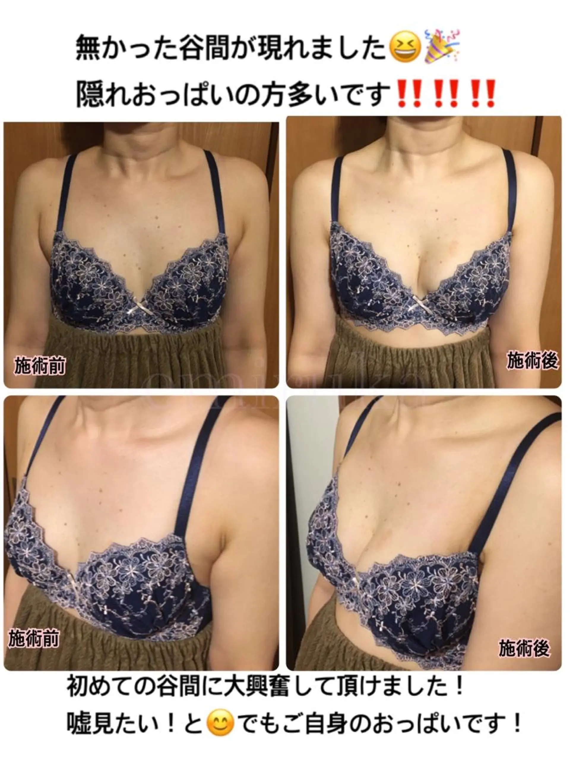 バストサロン emiruka所属・バストアップサロン エミルカのその他イメージ