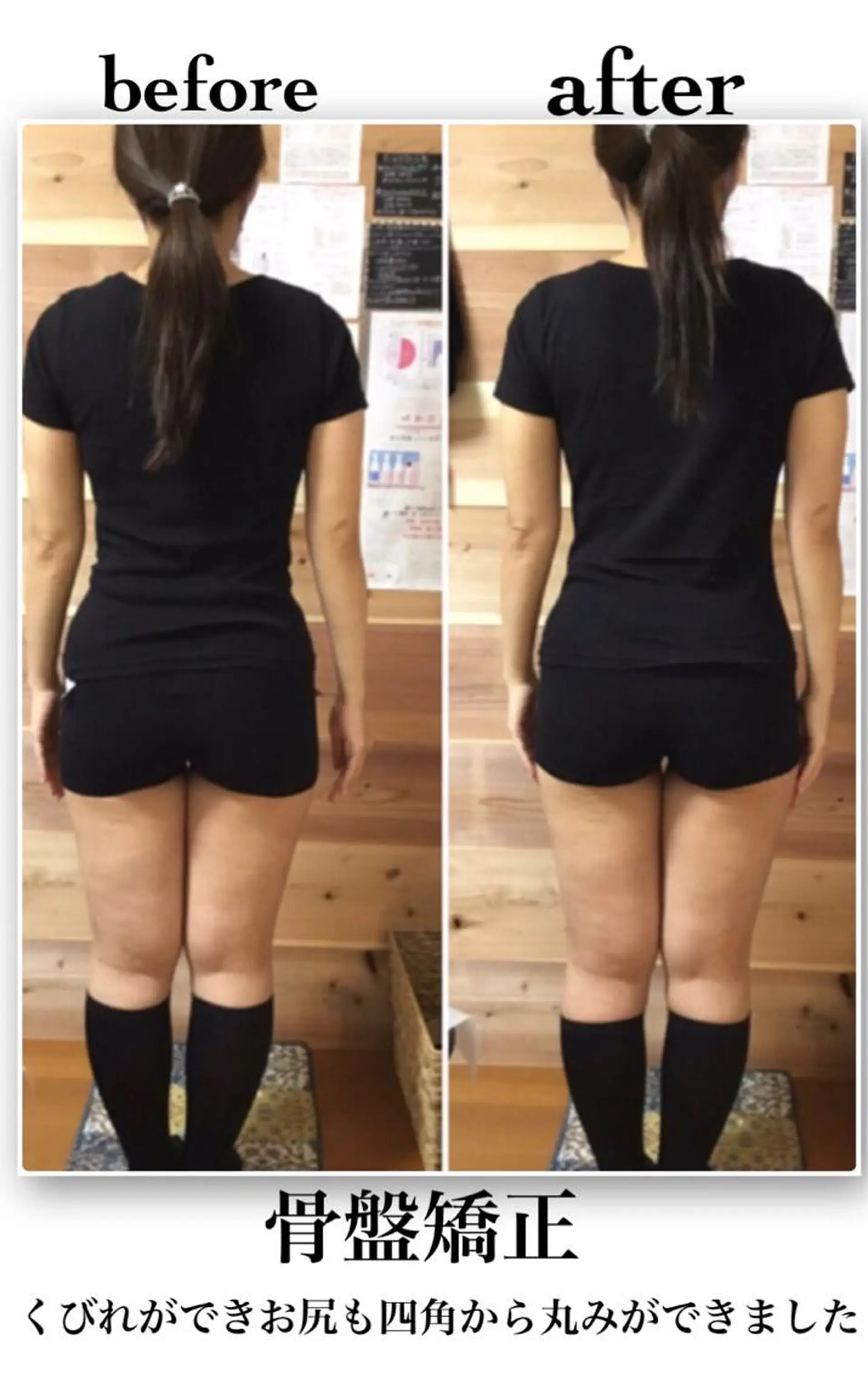 private salon  Dea_maris シュガーリング＆パーソナルボディケア所属・シミ改善・韓国肌管理 ボディメイク痩身のその他イメージ