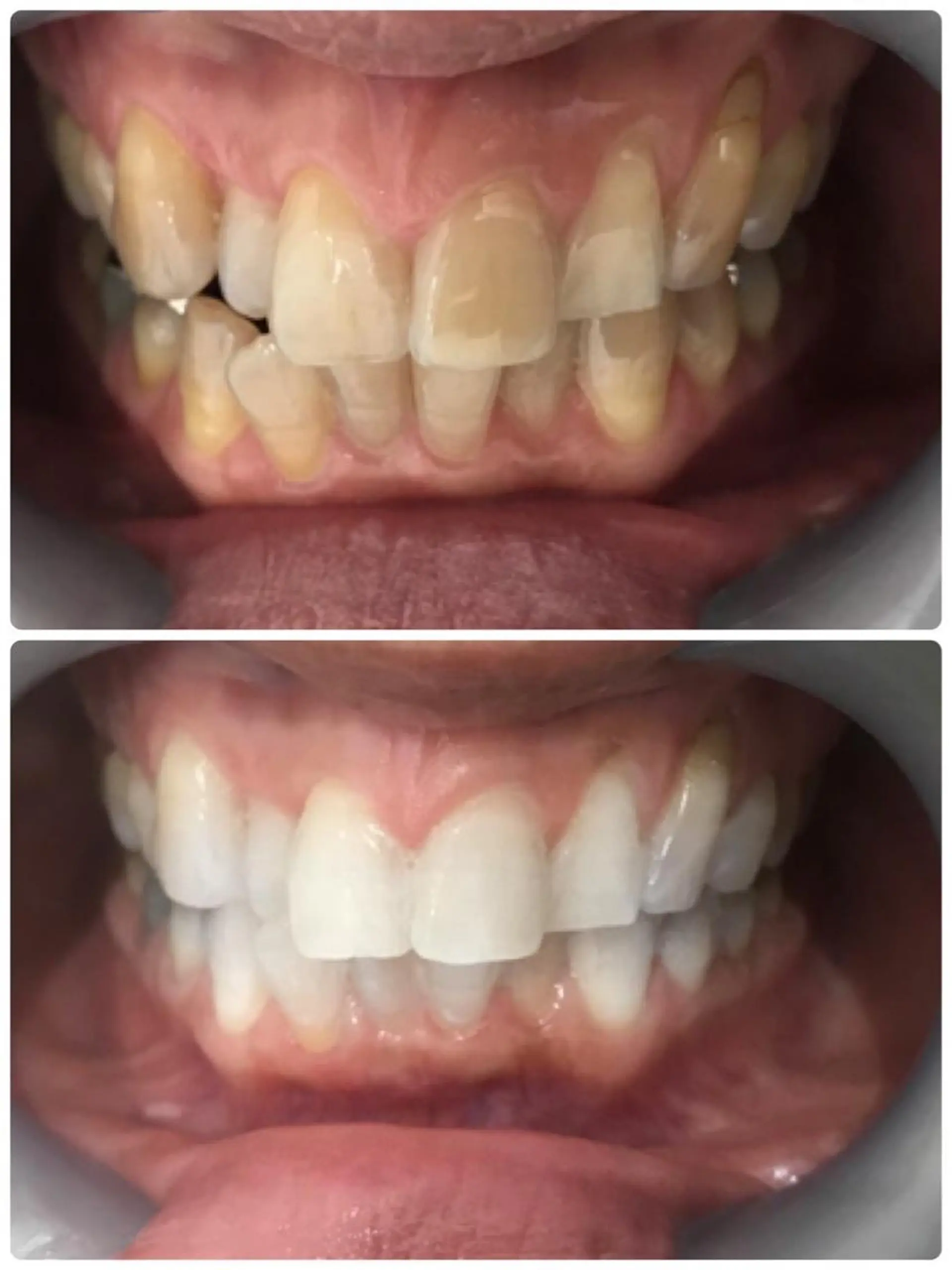 Monreve所属・美人スイッチdiet スーパージェクションのその他イメージ