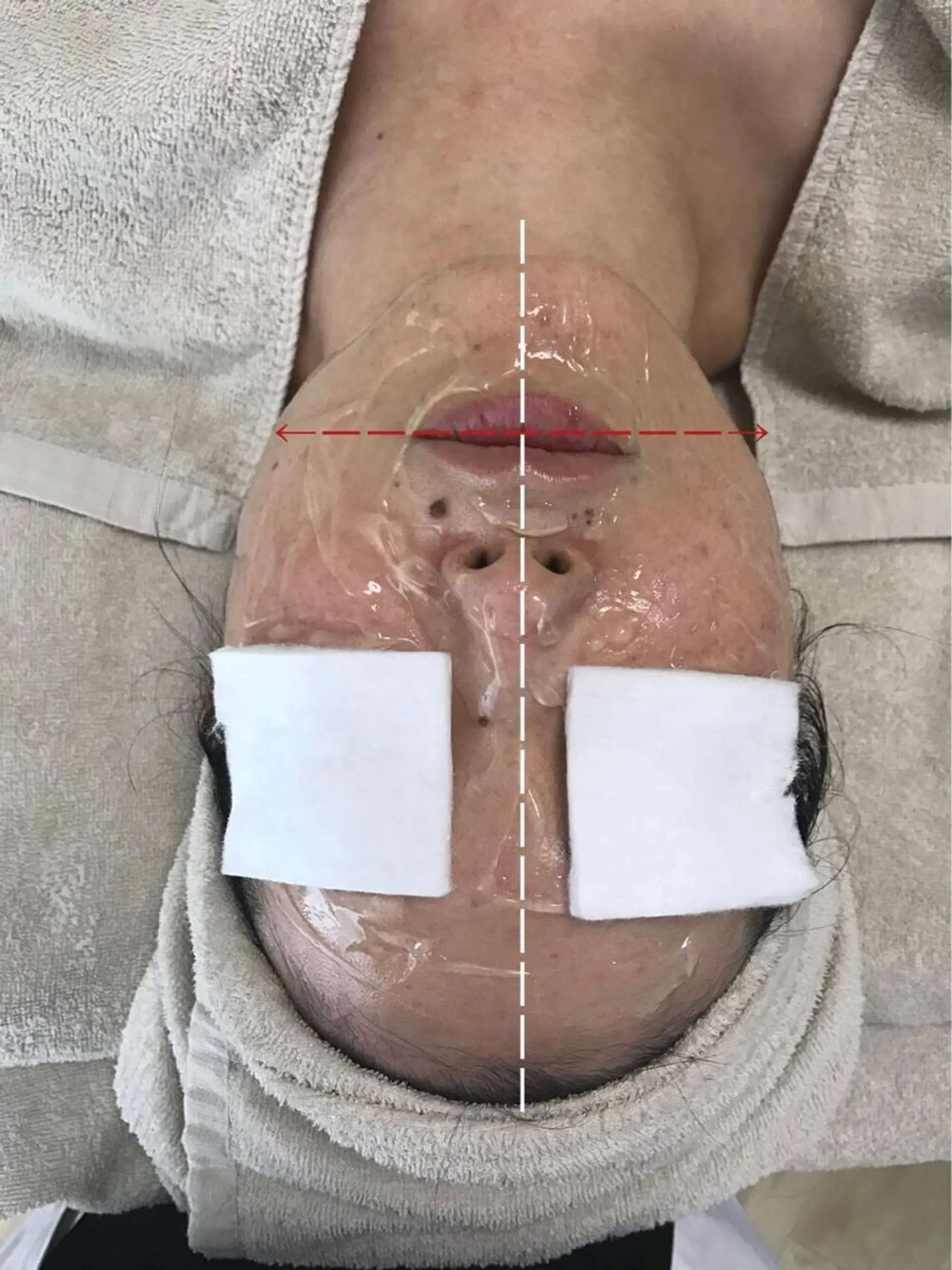 La beauté et santé岡崎店所属・望月 はるかのエステ・リラクイメージ