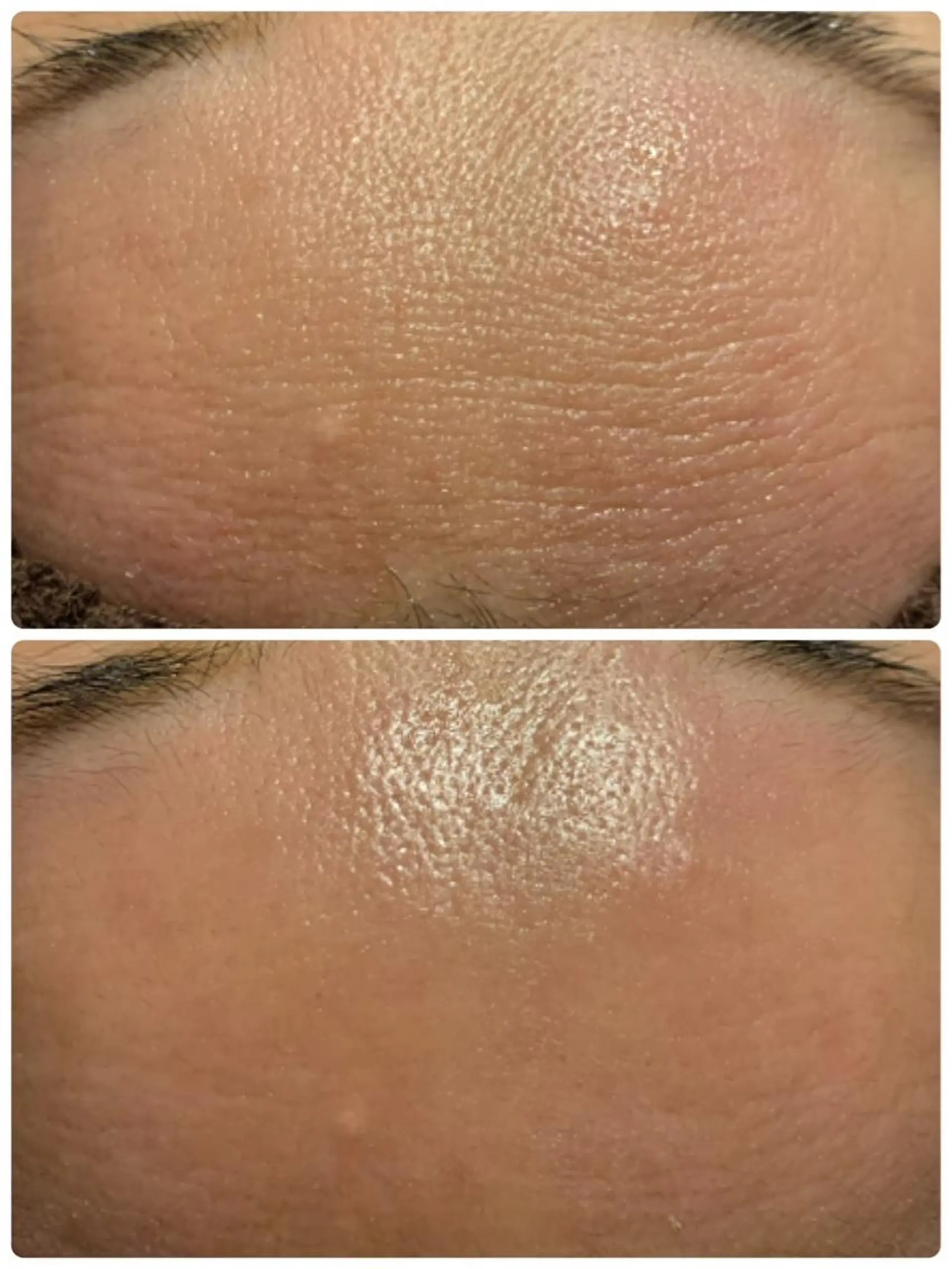 エステ aimee　肌質改善サロン【アイミー】所属・肌質改善サロン aimee｜アイミーのエステ・リラクイメージ