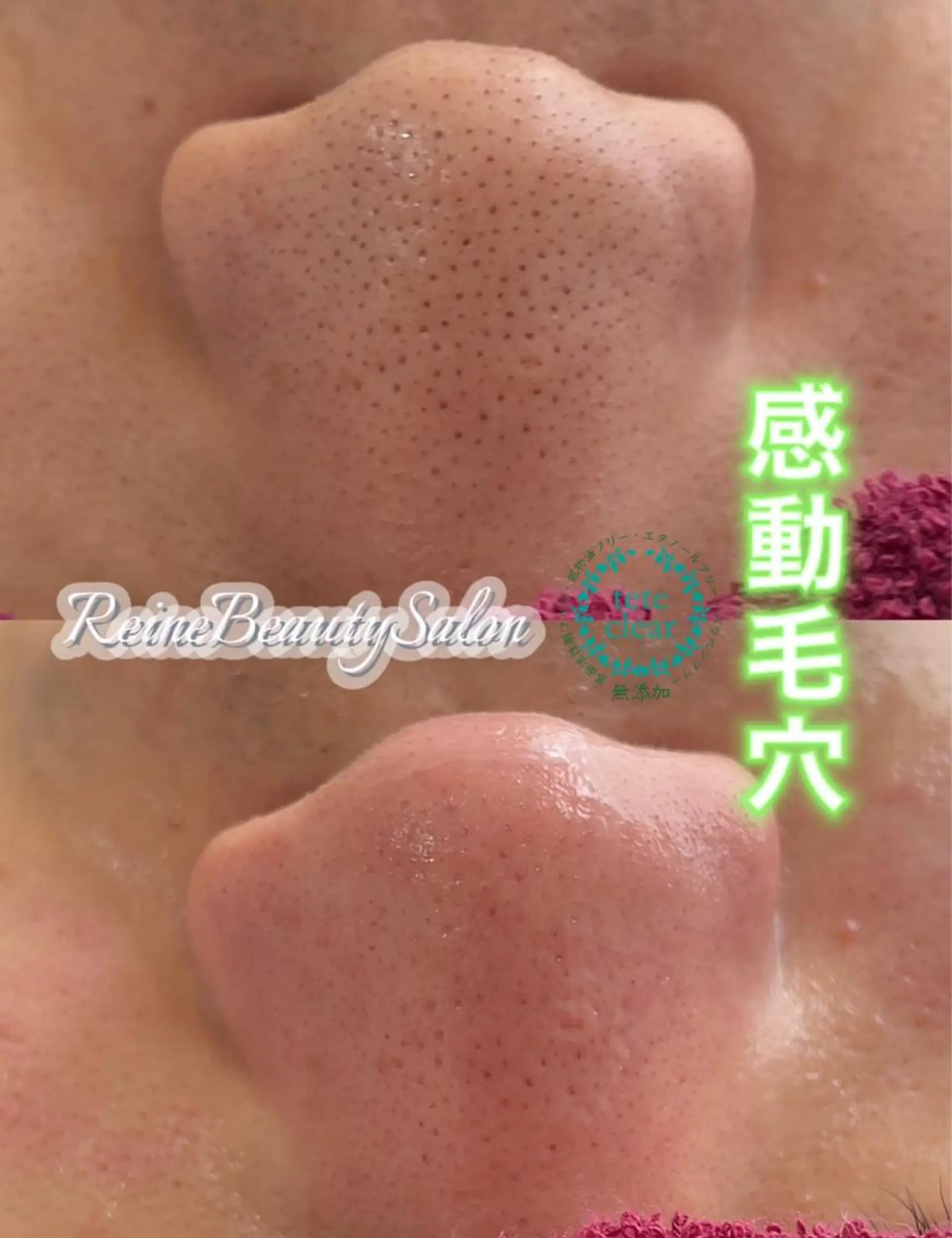 Reine BeautySalon所属・毛穴/シミ肝斑/脱毛 横山梨里のエステ・リラクイメージ