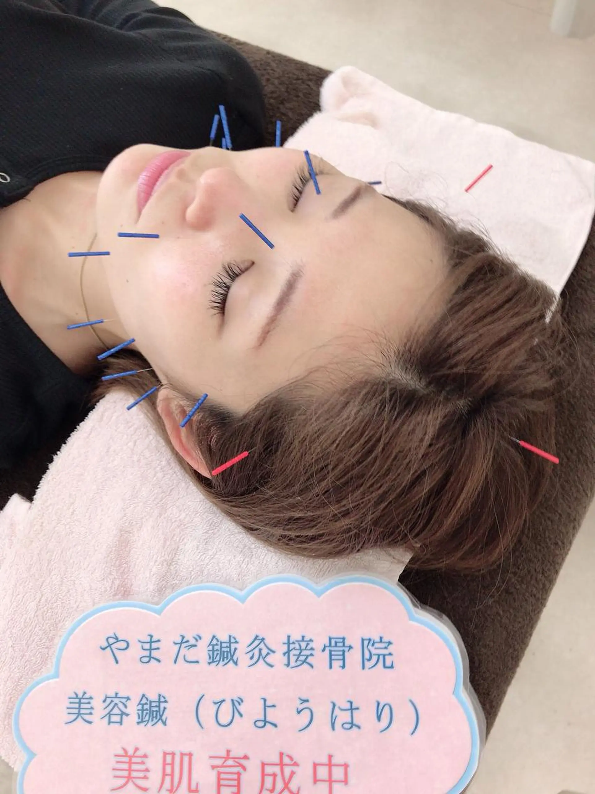 その他 やまだ鍼灸接骨院（やまだしんきゅうせっこついん）所属・山田 晃のエステ・リラクイメージ