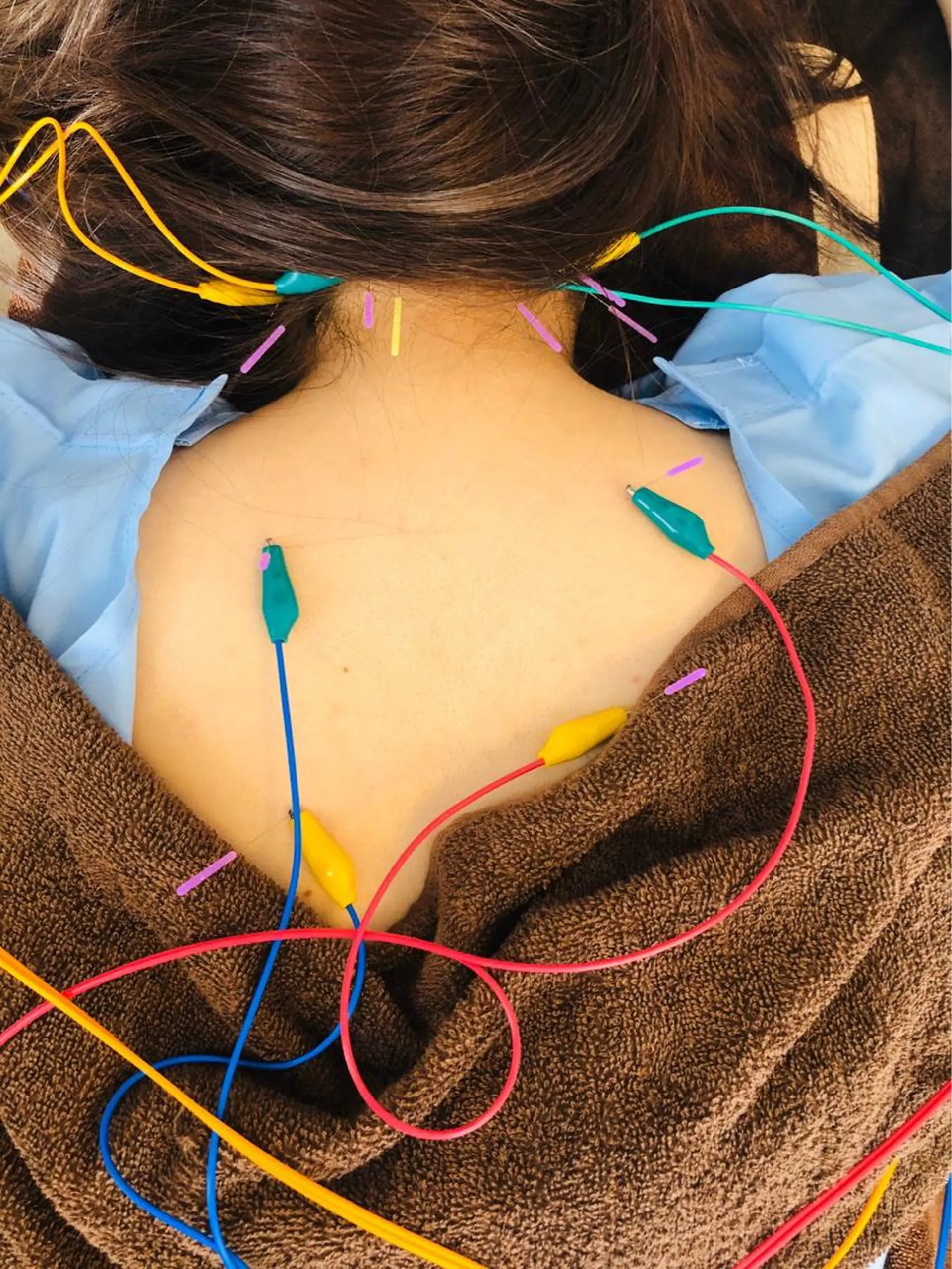 i鍼灸整体院所属・i鍼灸整体院 石井宏和のエステ・リラクイメージ