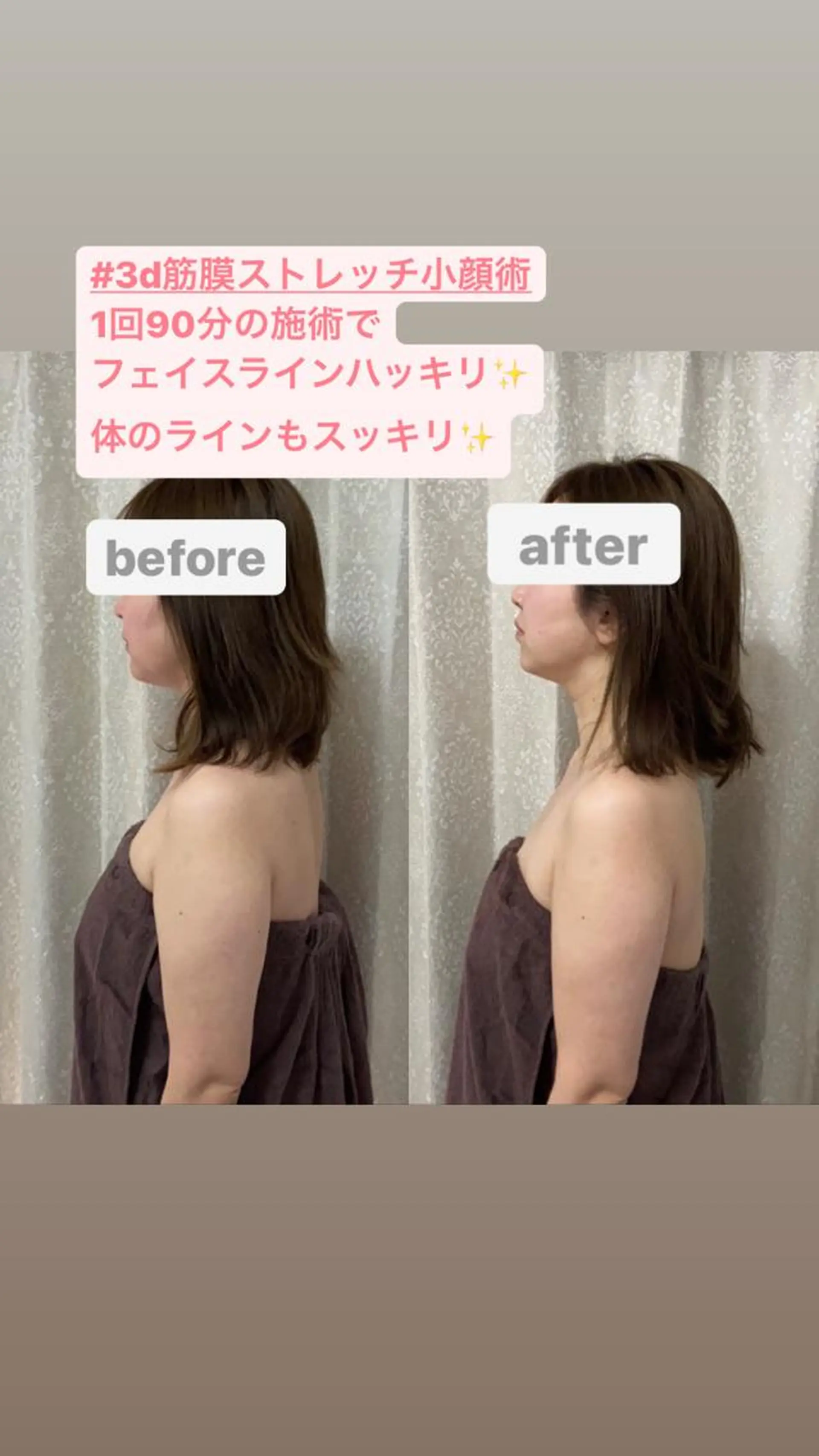 エステ リラク 長堀橋エステサロン charmignonのエステ・リラクイメージ