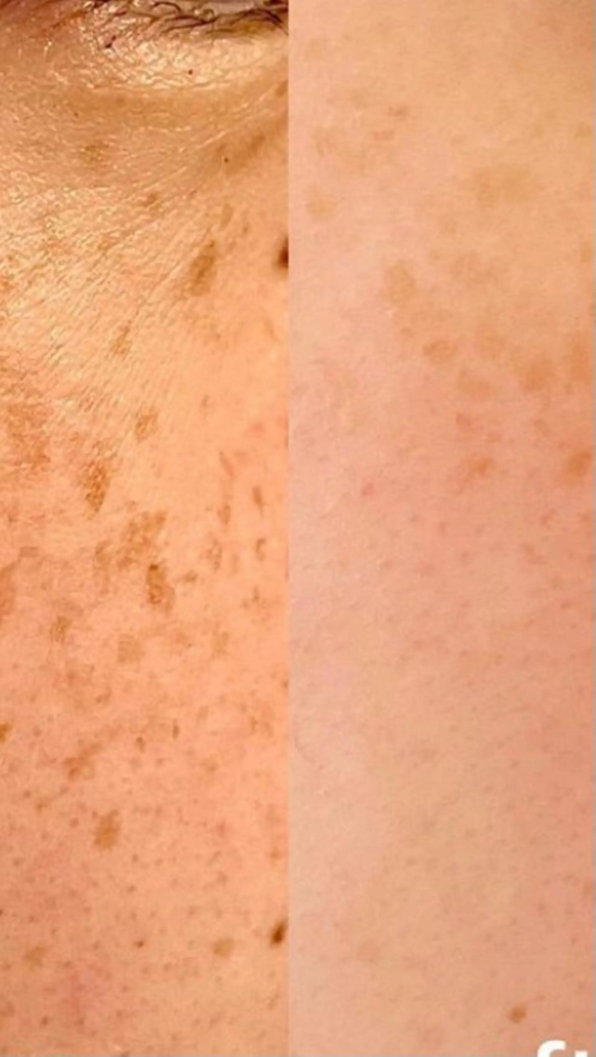 ポーラザビューティー松原店所属・ポーラ松原店 北口のエステ・リラクイメージ