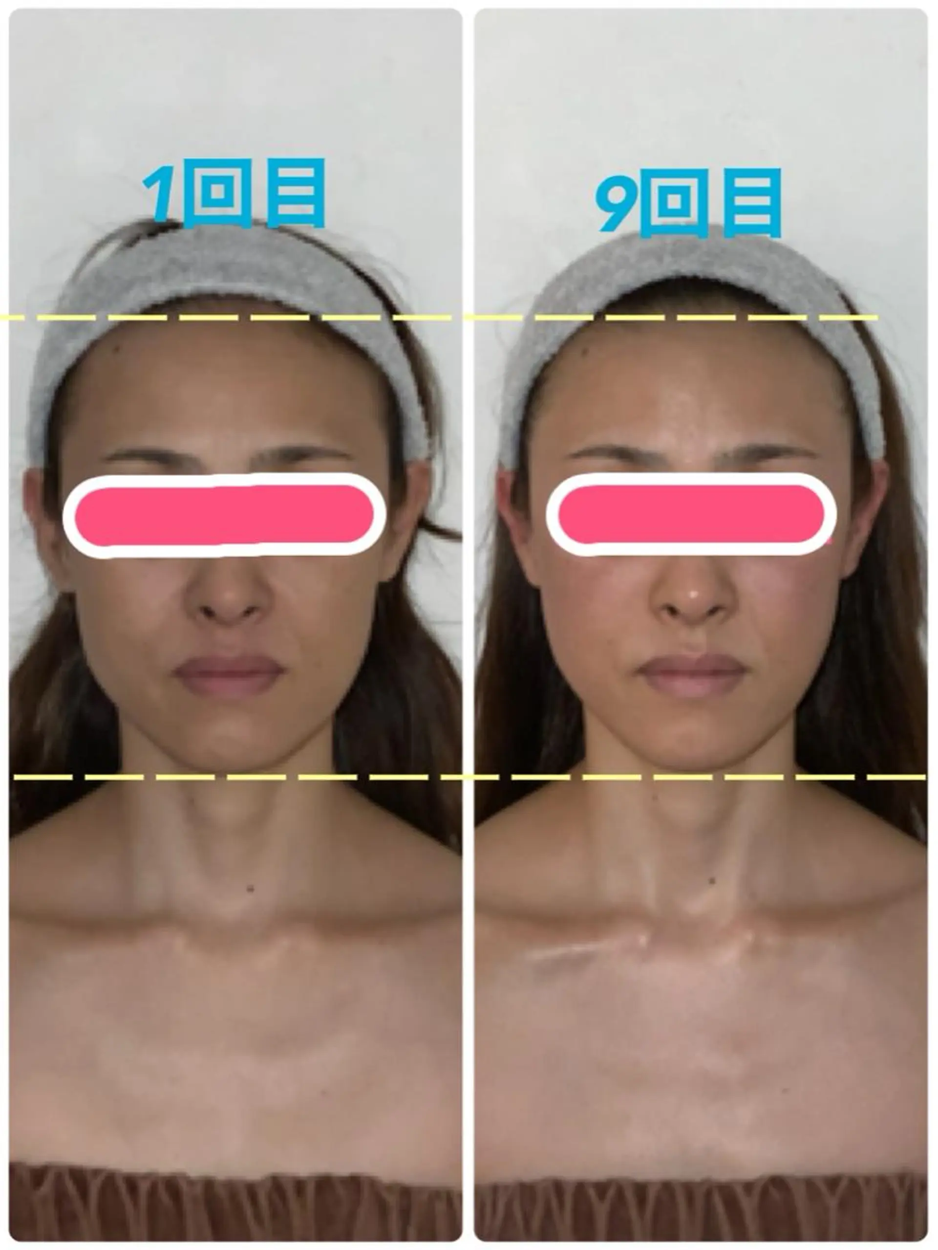 小顔プランナー辰巳 愛美のエステ・リラクイメージ