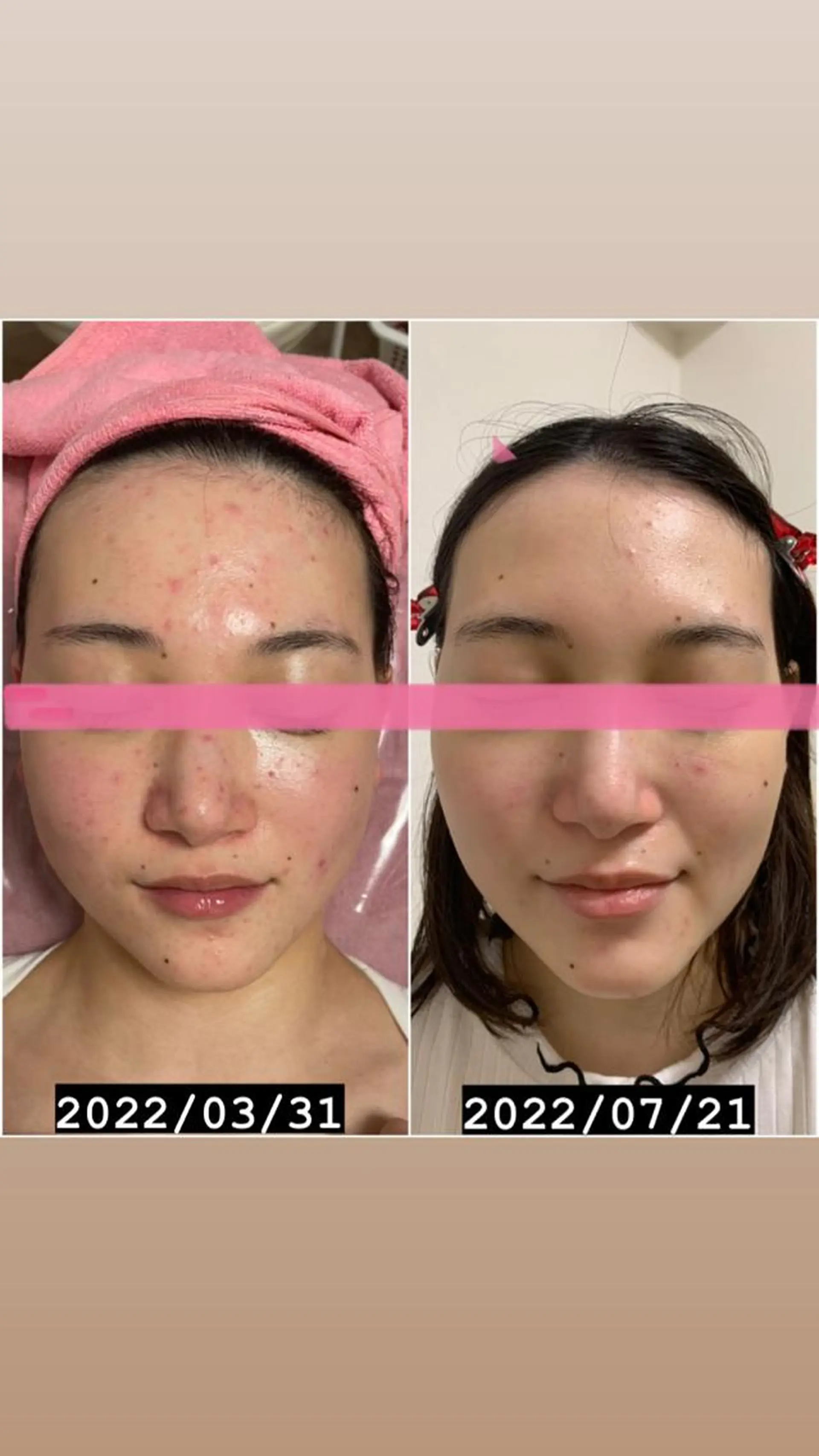 エステ リラク 透明感の肌Lino malieのエステ・リラクイメージ