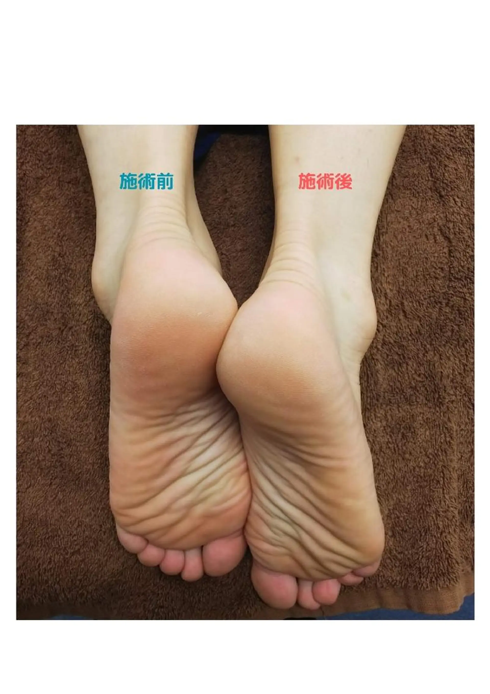 ACORAL整体 エステちあきのその他イメージ