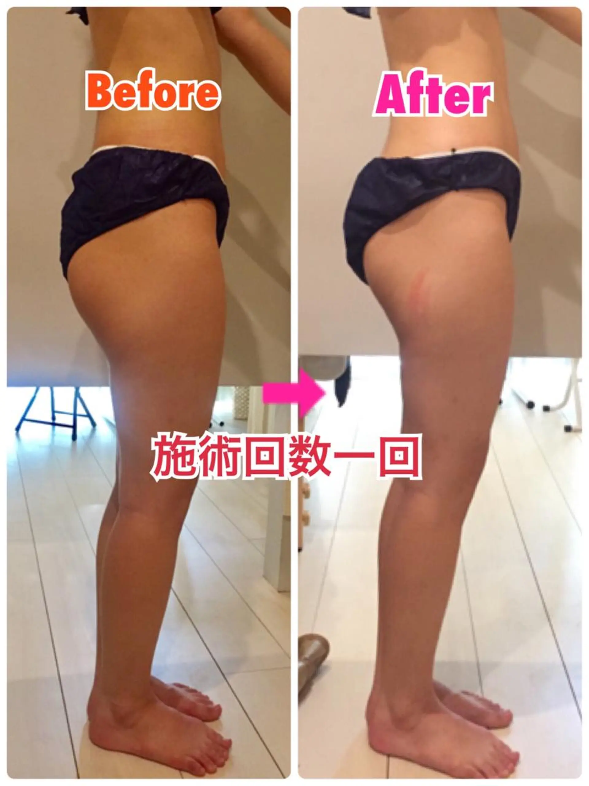 ロング カラー パーマ ヘアアレンジ メンズ キッズ ネイル マツエク・マツパ マットネイル ‍痩身＆ボディ 結果出し🌟丹野のエステ・リラクイメージ