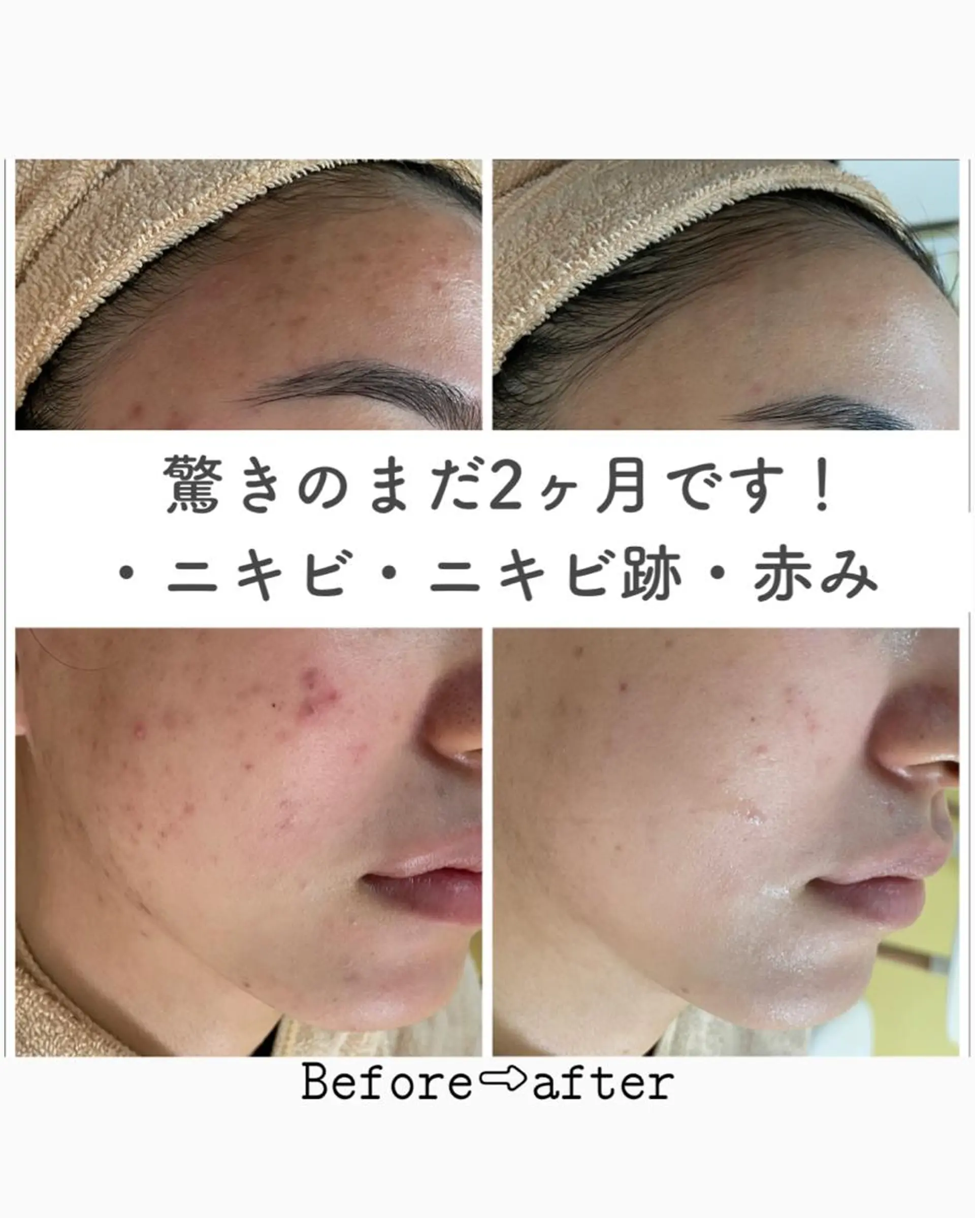 ショート カラー パーマ ヘアアレンジ メンズ キッズ ネイル マツエク・マツパ エステ ニキビ&跡改善サロン オーナー光木のエステ・リラクイメージ