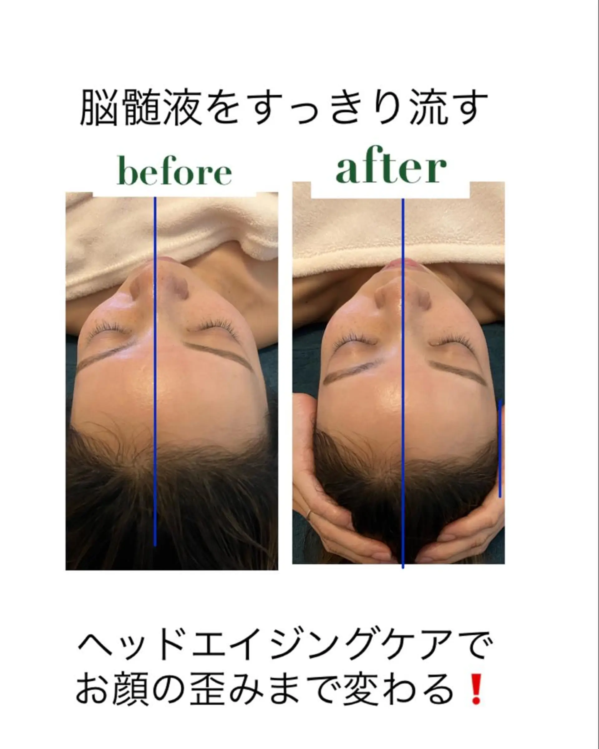 ヘッドスパ ３歳～フォト美肌脱毛 Dione湘南藤沢店のエステ・リラクイメージ