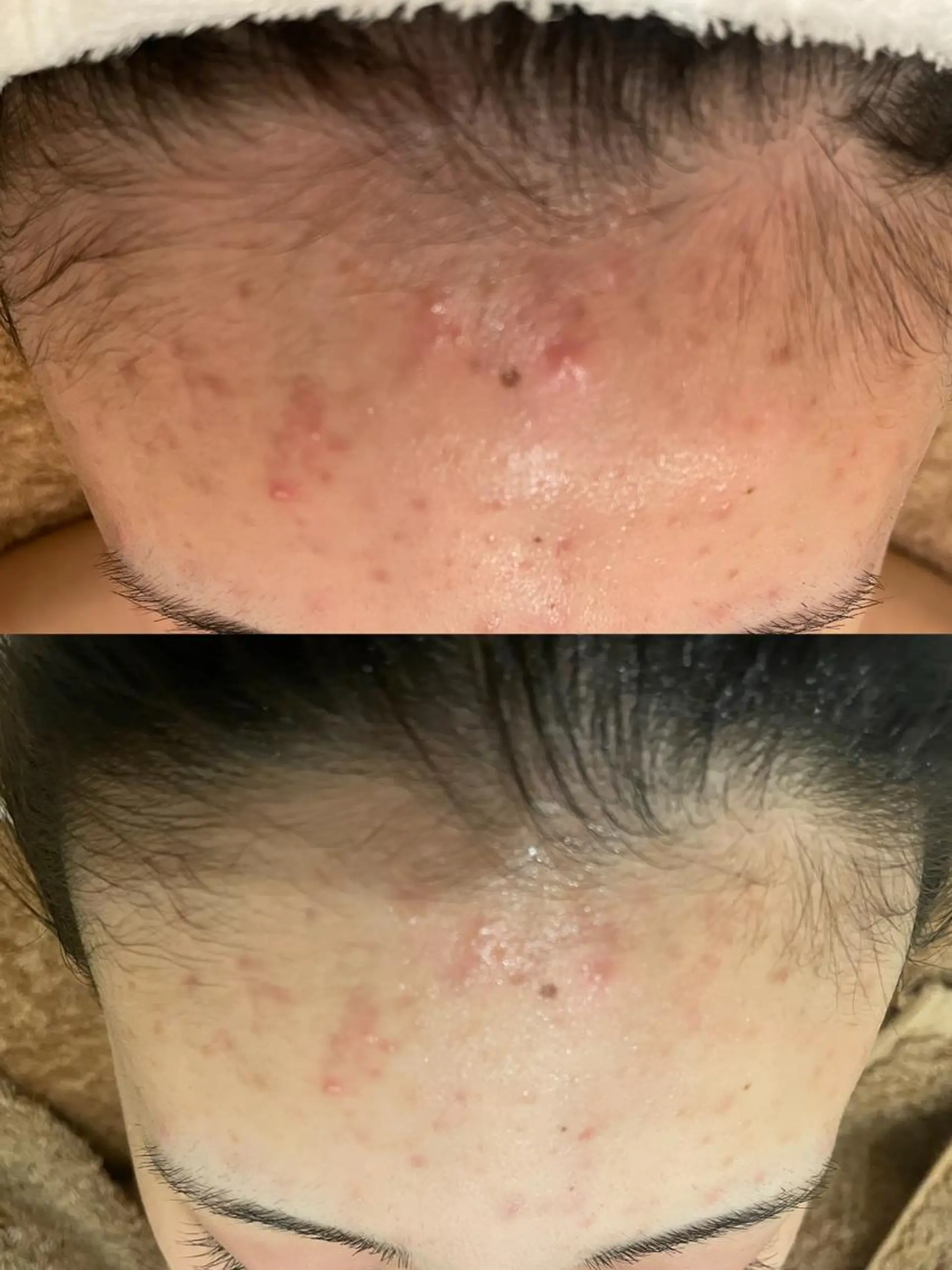 エステ リラク メナードフェイシャルサロン　片町所属・メナードフェイシャル サロン片町店ハタケのエステ・リラクイメージ