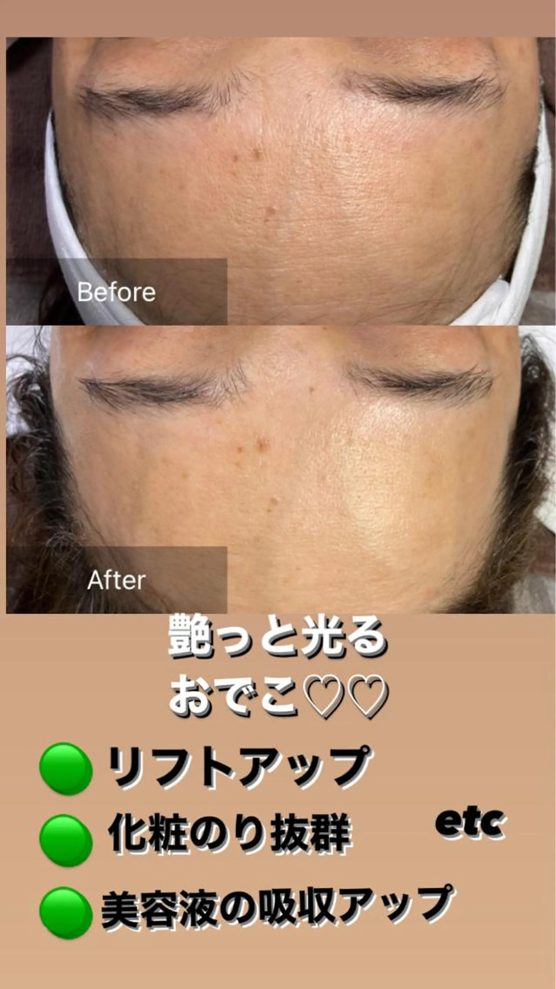 脱毛 産毛専門店 Bittoのエステ・リラクイメージ