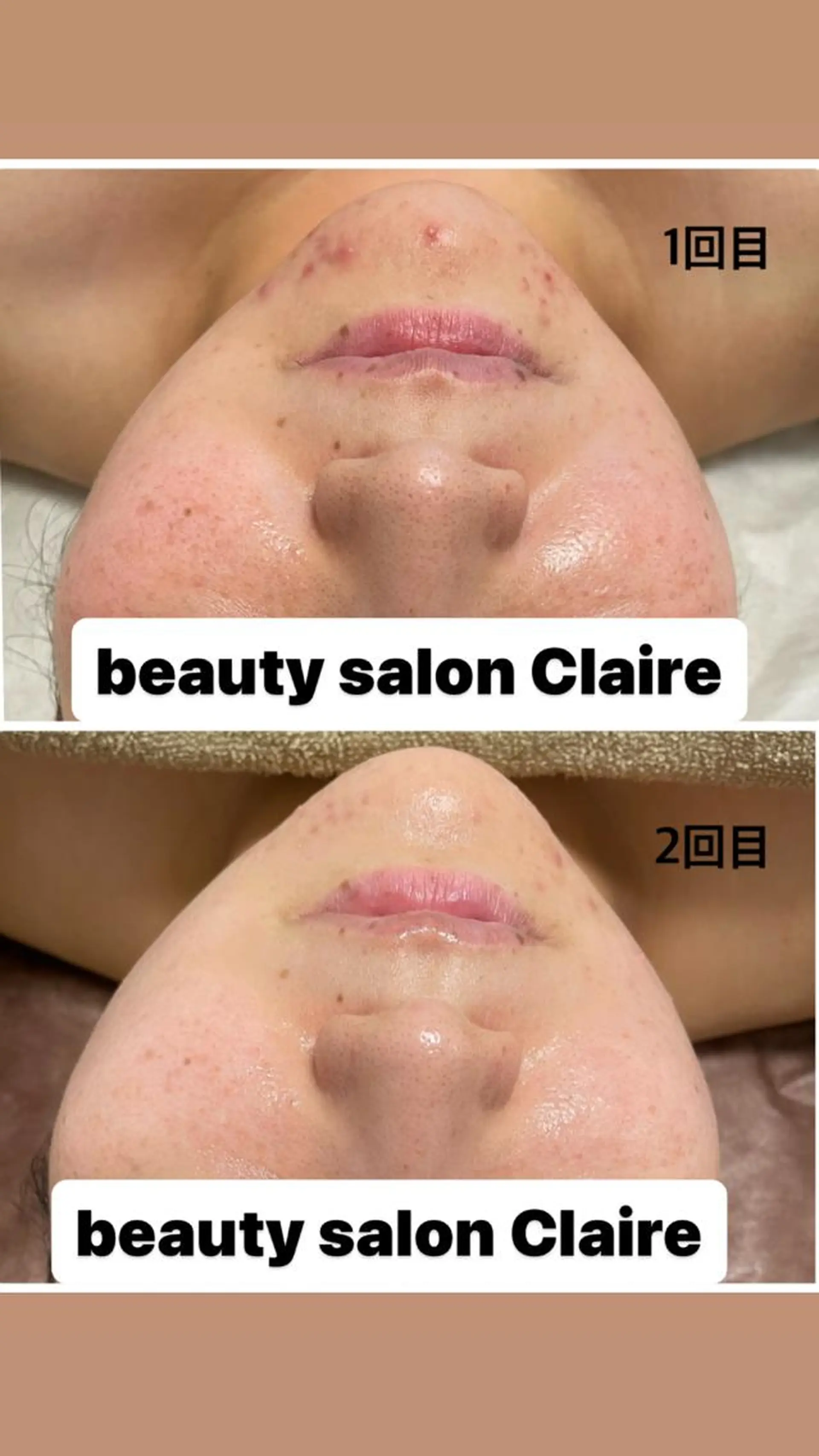 エステ リラク ビューティーサロン Claireのエステ・リラクイメージ