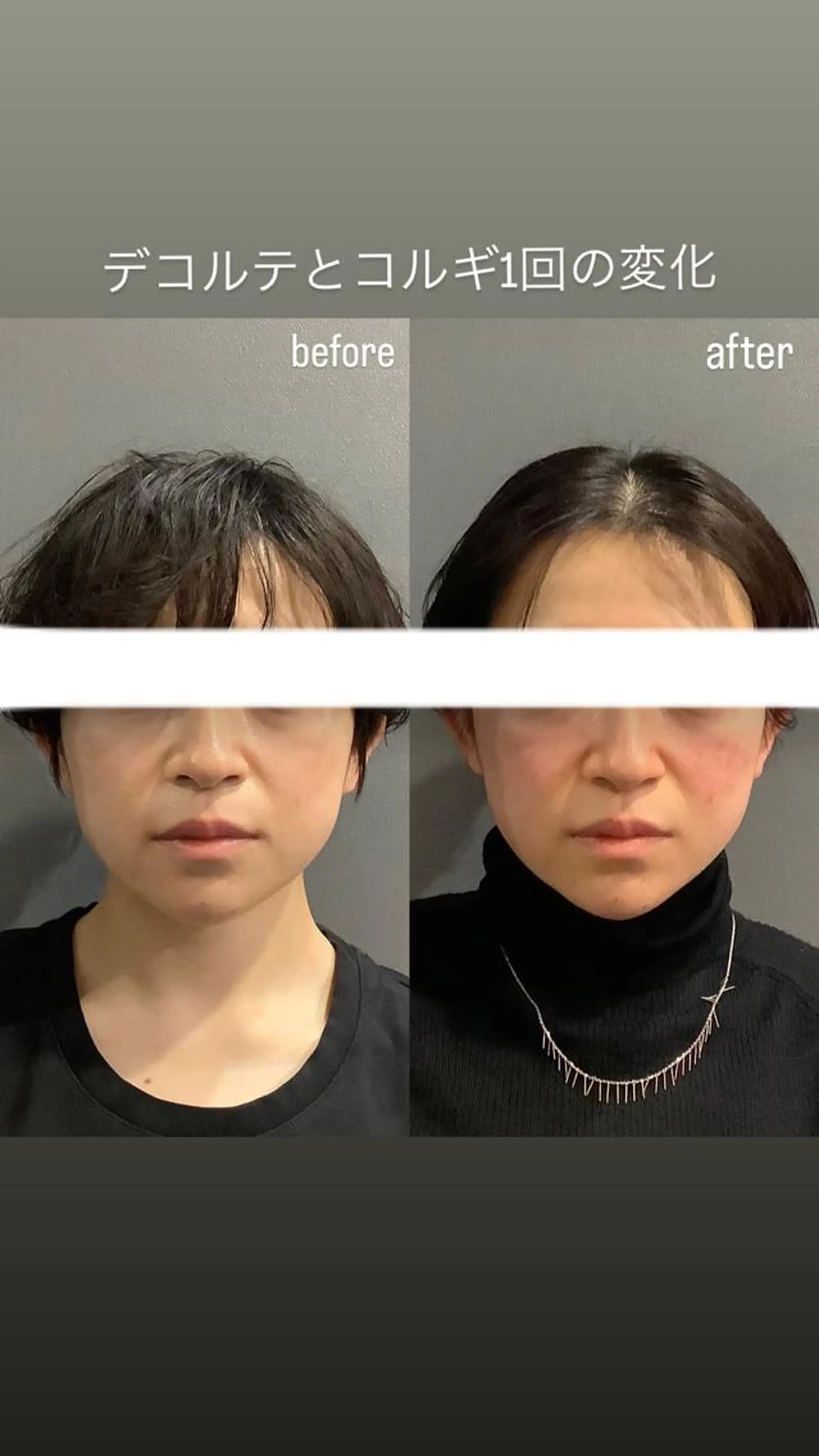 エステ リラク エステサロンino.colore'所属・小顔サロン ino.coloreのエステ・リラクイメージ