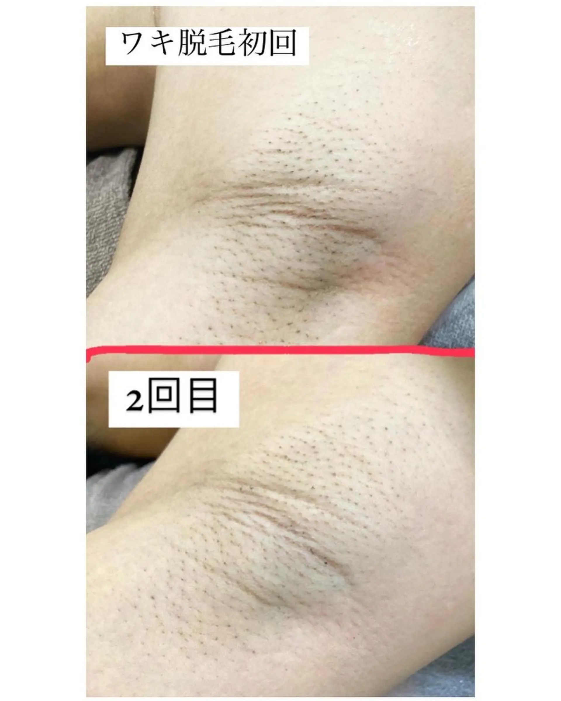 脱毛サロン Lil所属・脱毛サロン Lilのエステ・リラクイメージ